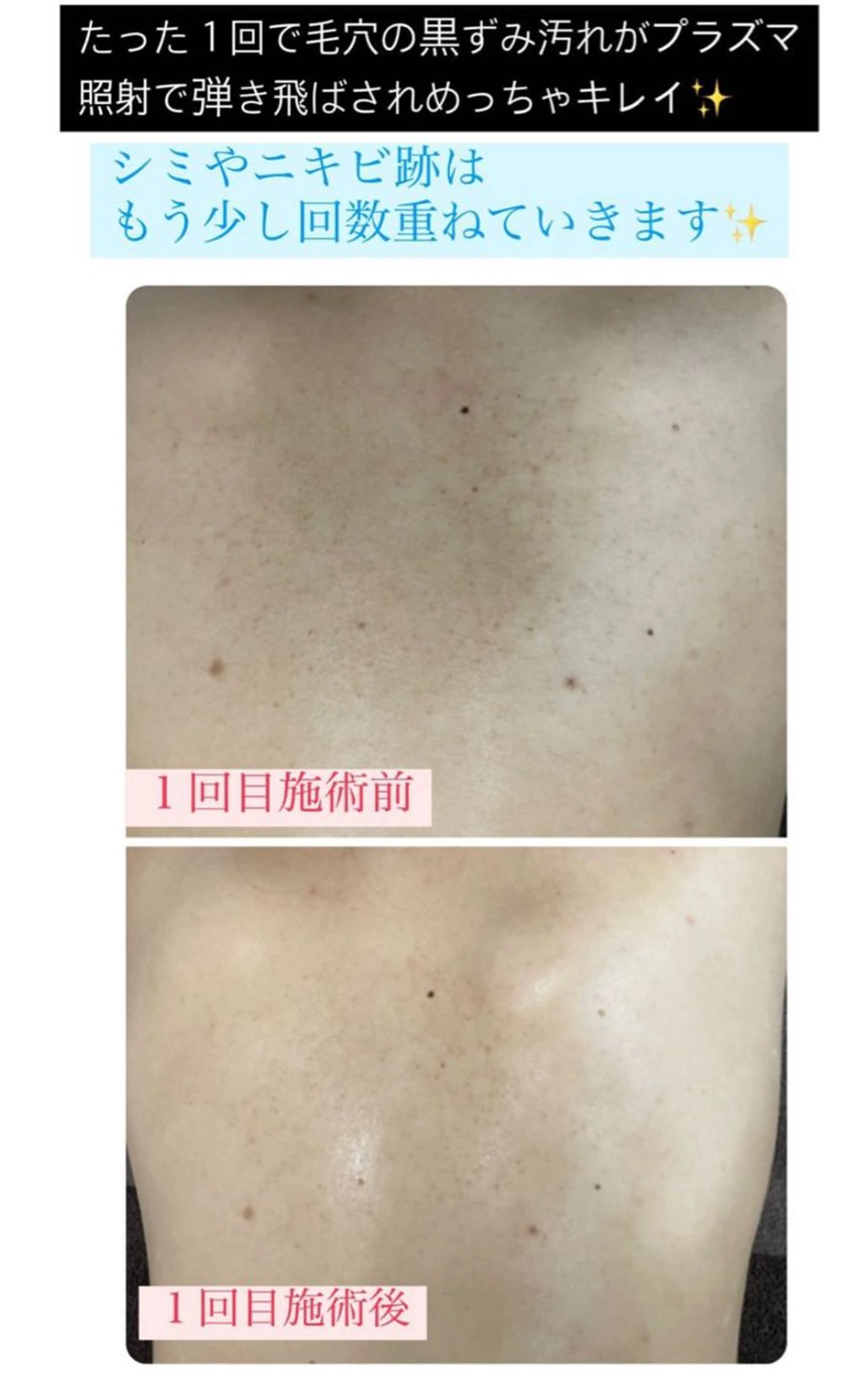 エステ ベラージュ【美背中・ 美尻・フェイシャル】のエステ・リラクイメージ