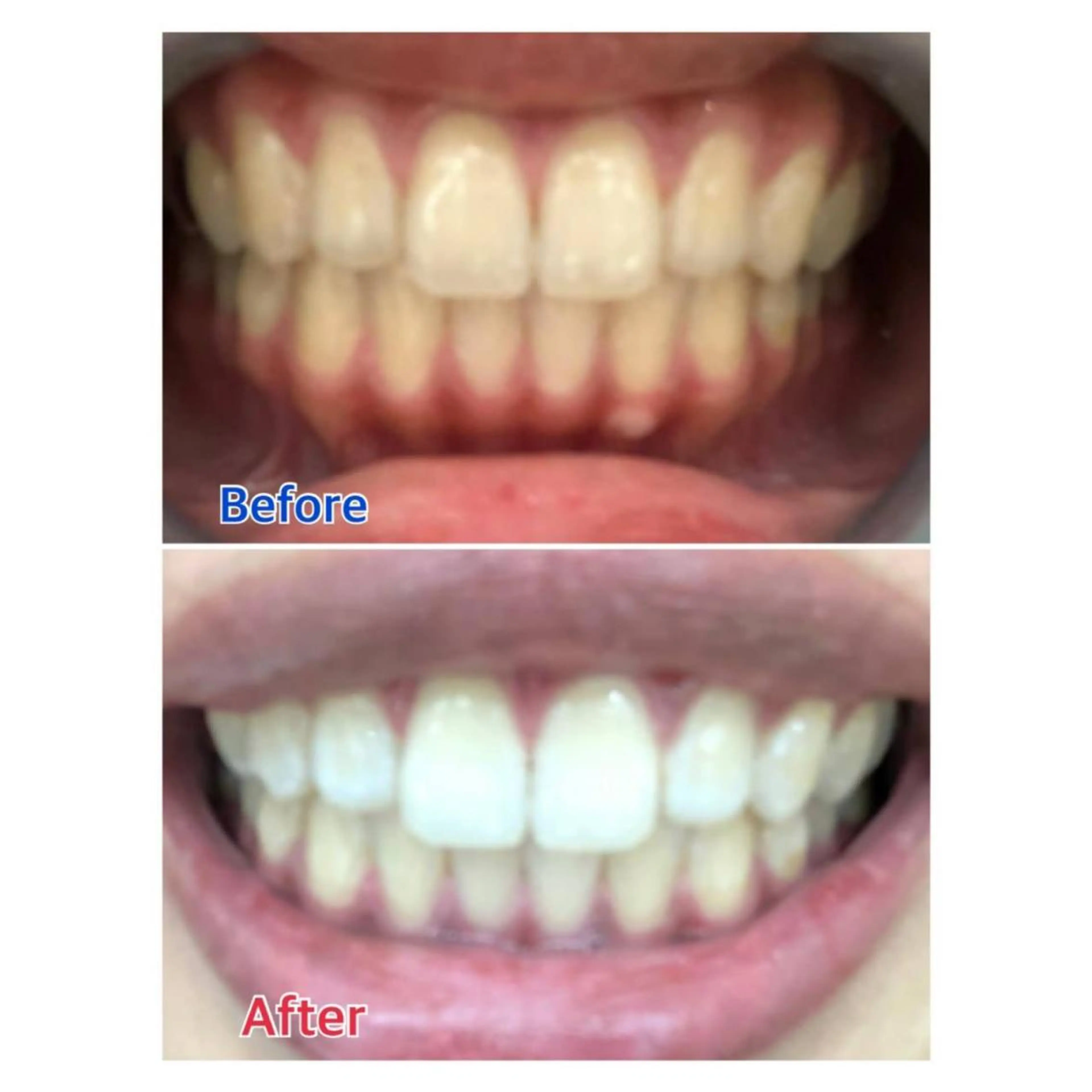 MBEAUTYSALON 千葉店・京成大久保所属・Melty 輝のその他イメージ