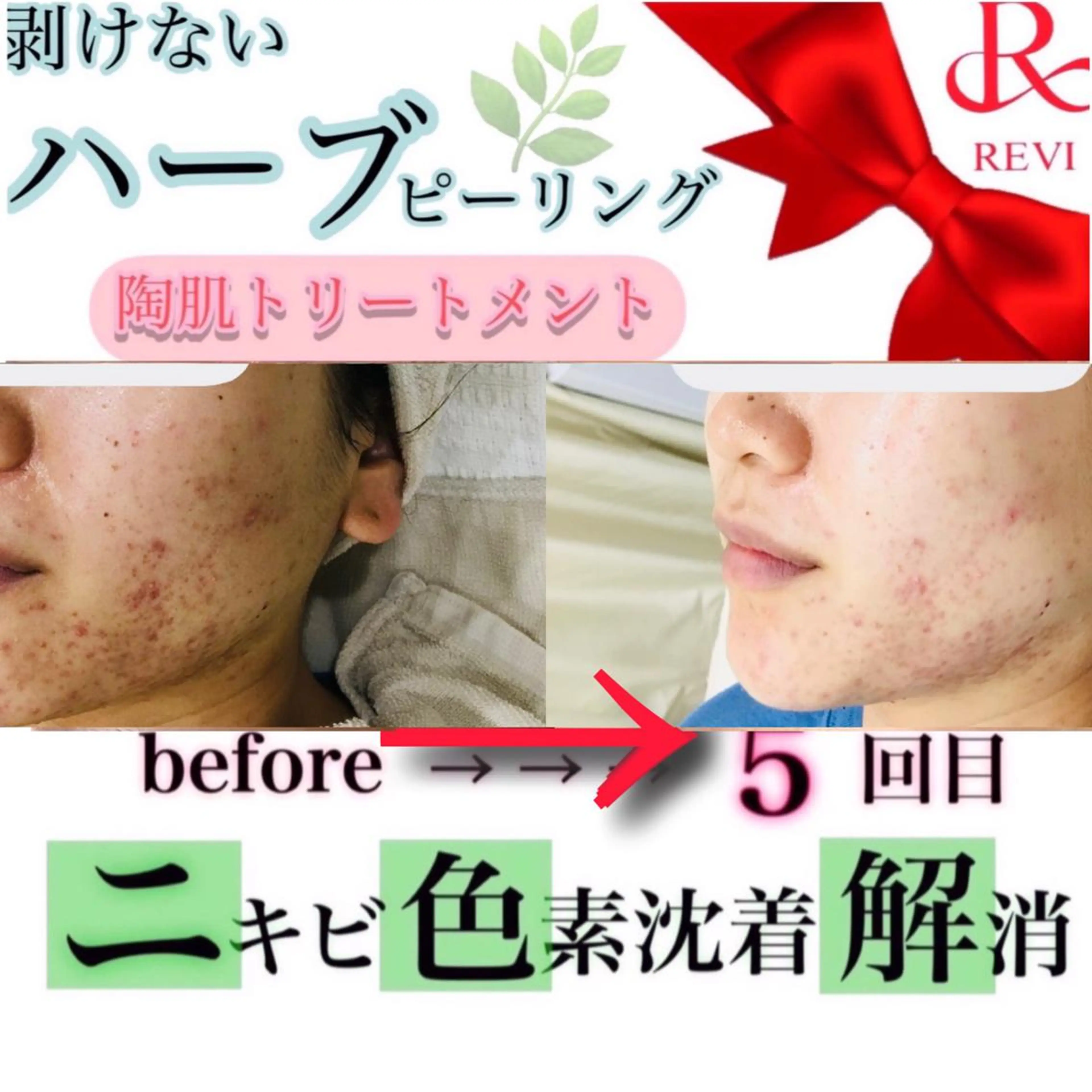 laluna saki...のその他イメージ