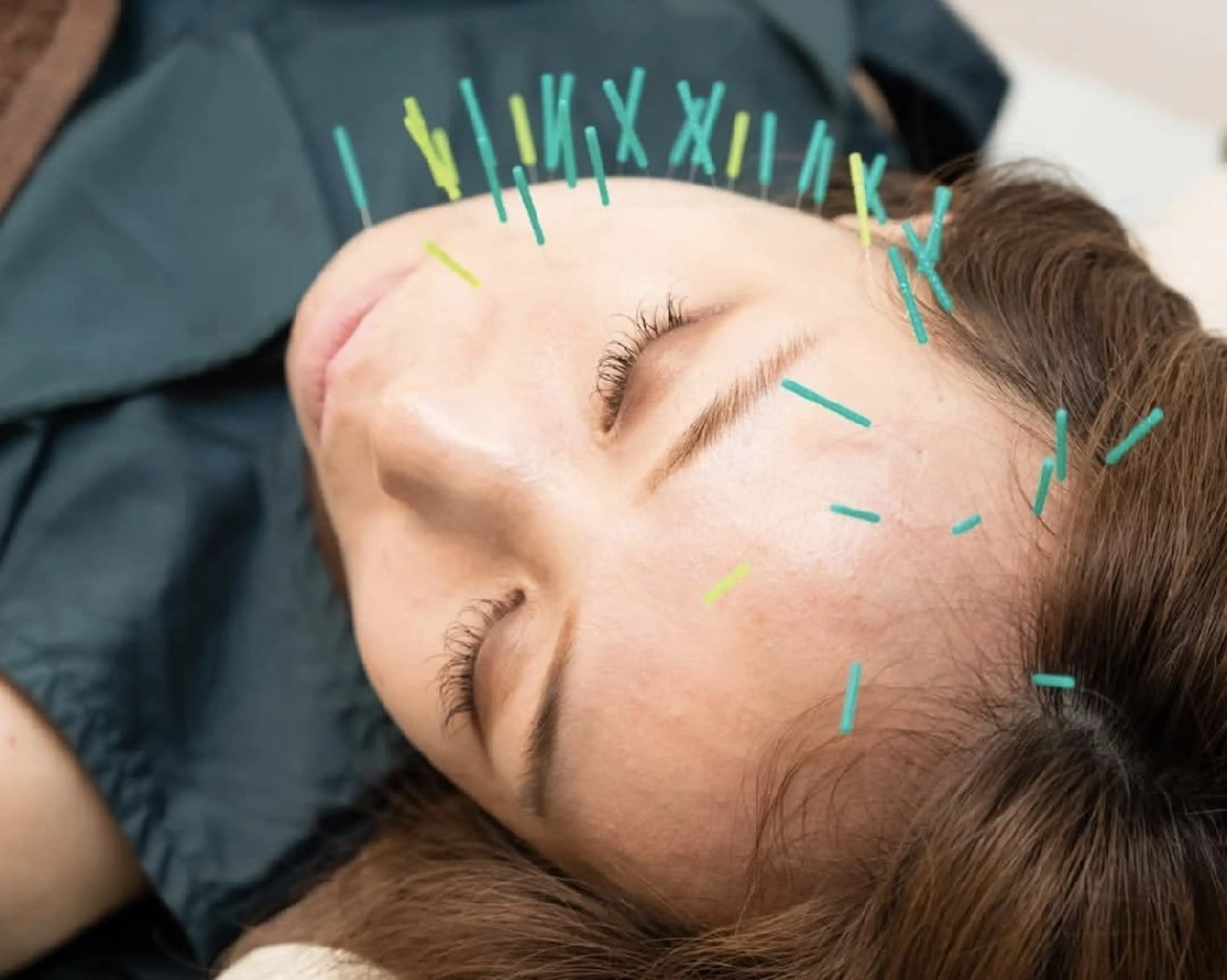 エステ リラク 北梅田美容鍼灸院所属・美容鍼マイスター 川村　淳のエステ・リラクイメージ