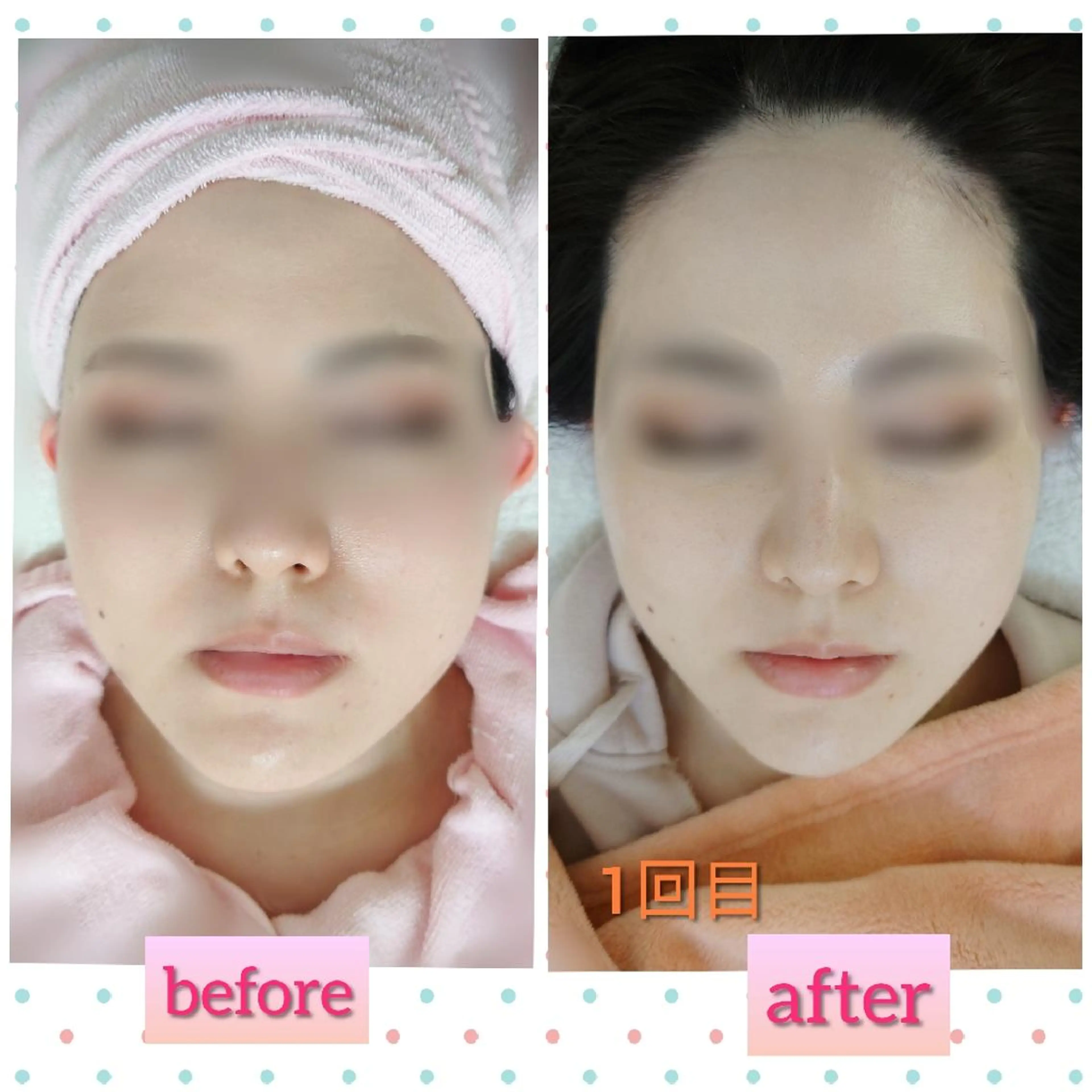 エステ 森野 梢のマツエク・マツパデザイン