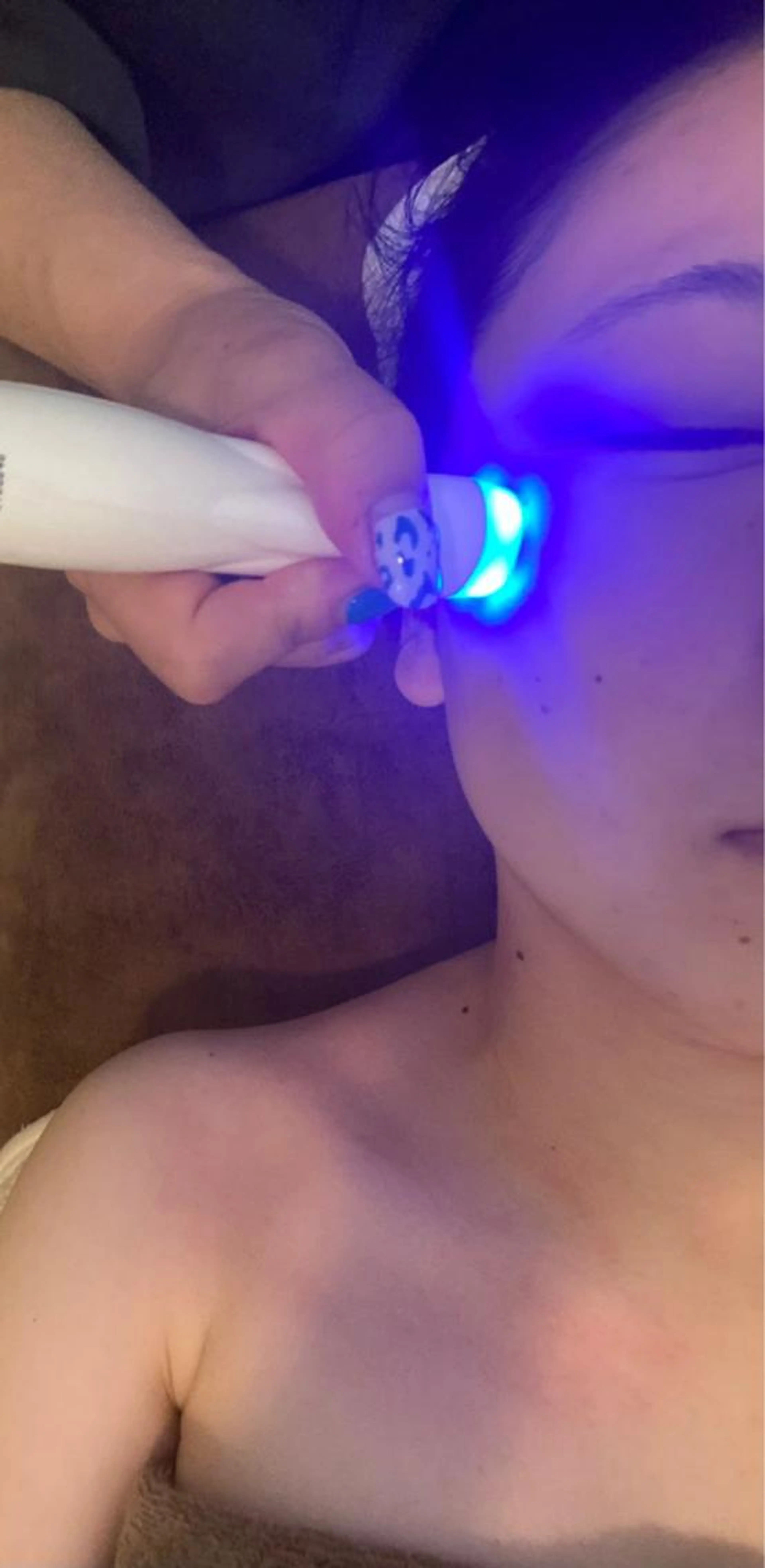 ❤︎ラジオ波フェイシャルトリートメントでリフトアップ❤︎の写真