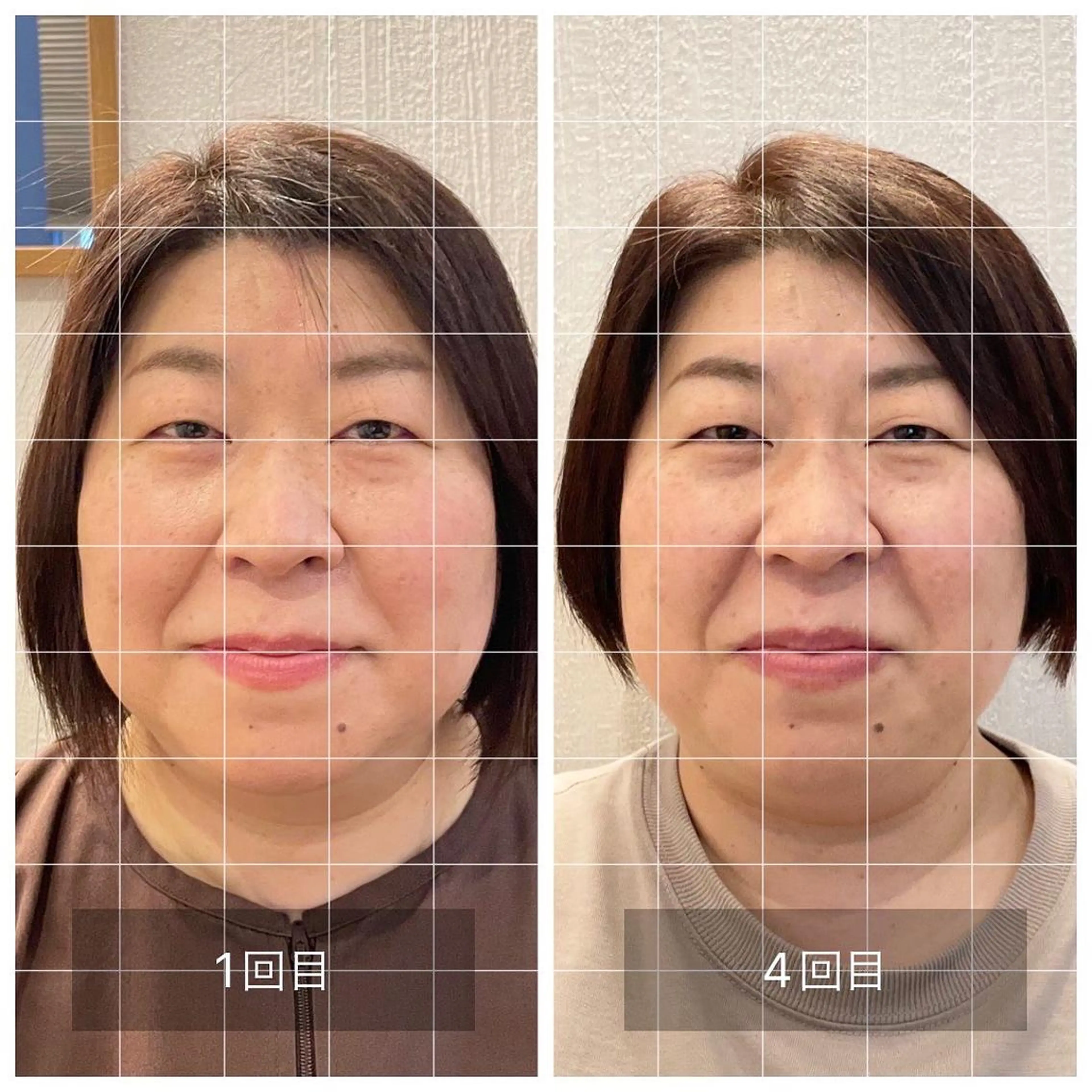 美容鍼　蒼月-aotsuki-所属・美容鍼「蒼月」 -アオツキ-のエステ・リラクイメージ