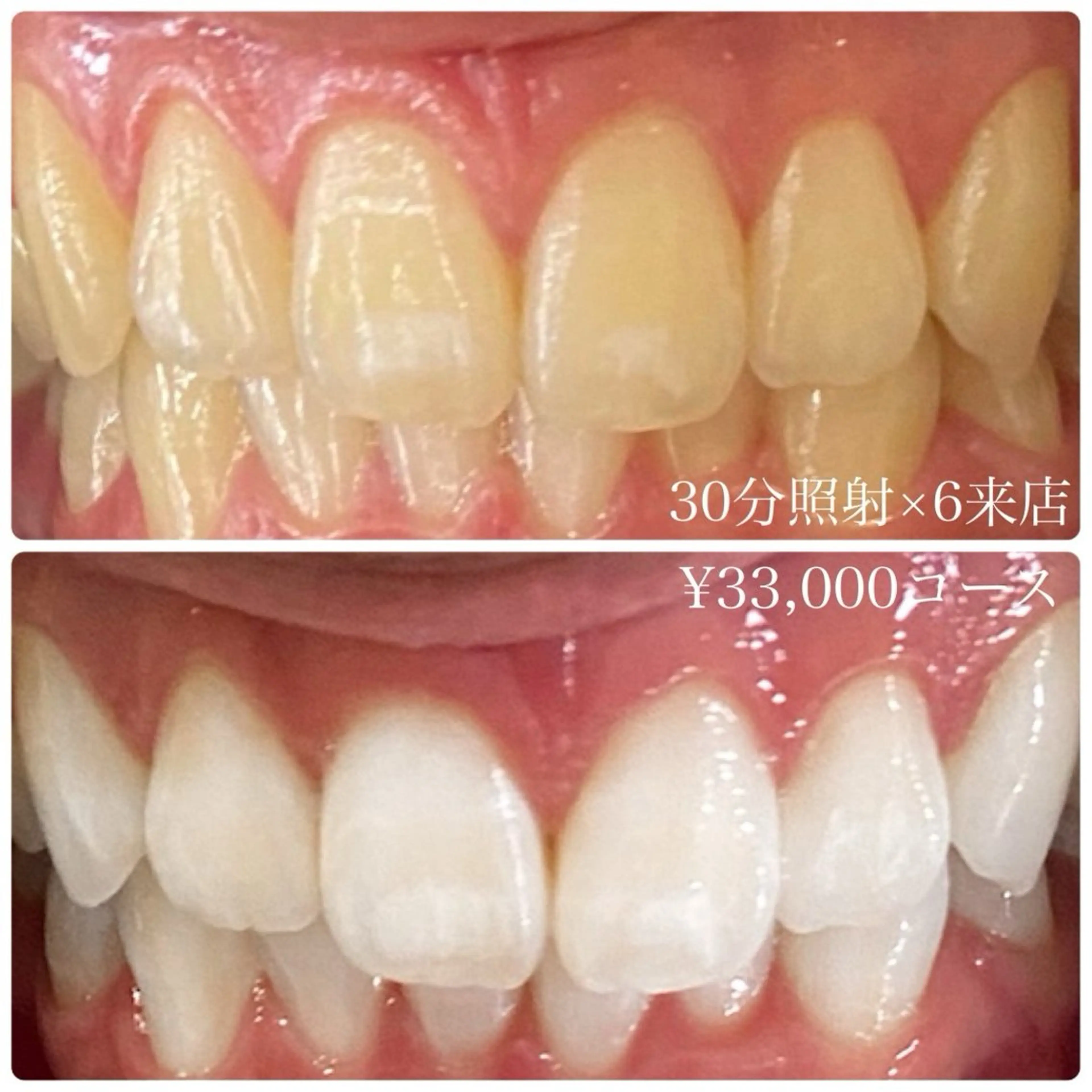 PLATINUM Beauty 横浜店所属・ホワイトニングルーム 横浜店のその他イメージ