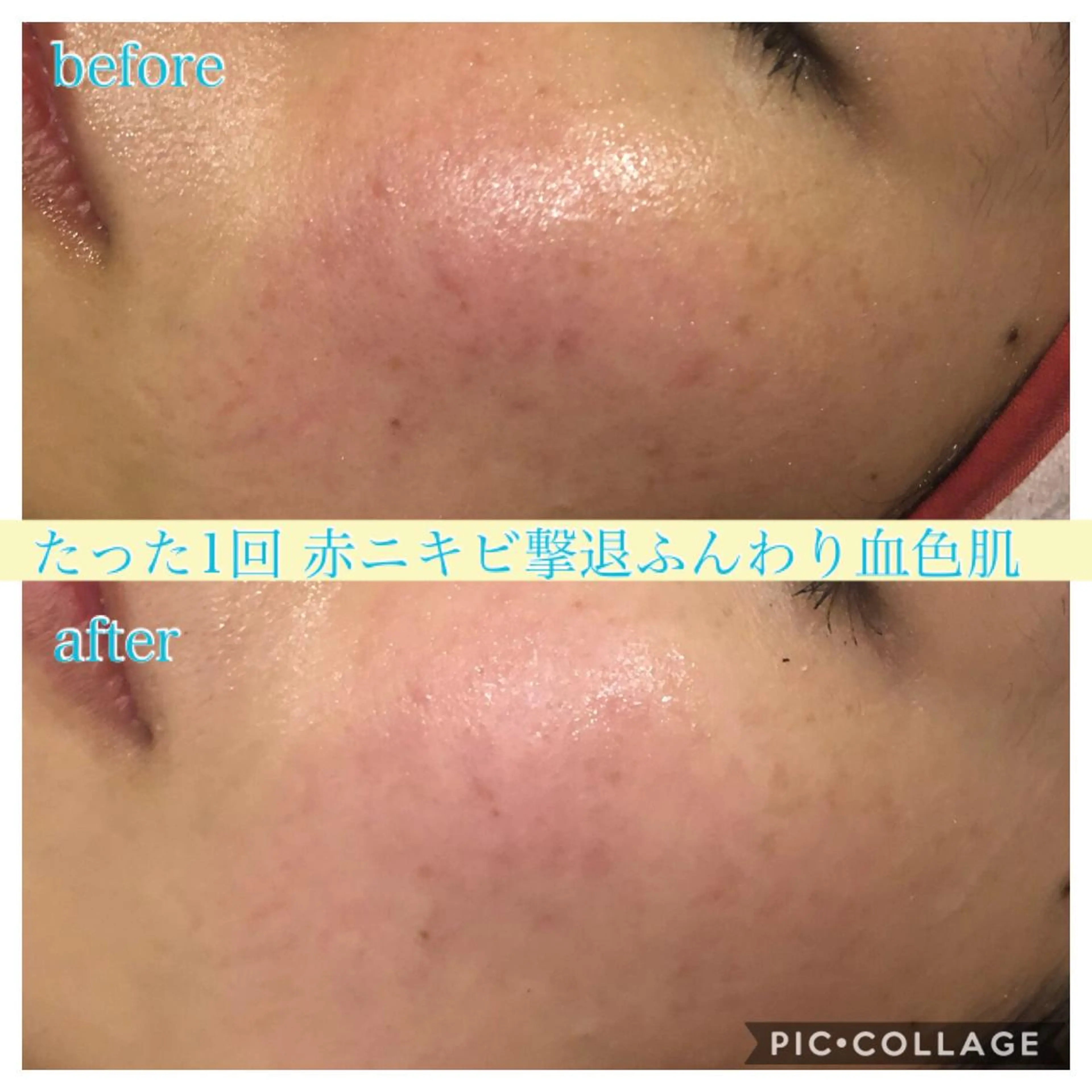 セミロング カラー パーマ ヘアアレンジ キッズ ネイル マツエク・マツパ エステ リラク Ensor Clair所属・EnsorClair 代表　野口真央のエステ・リラクイメージ