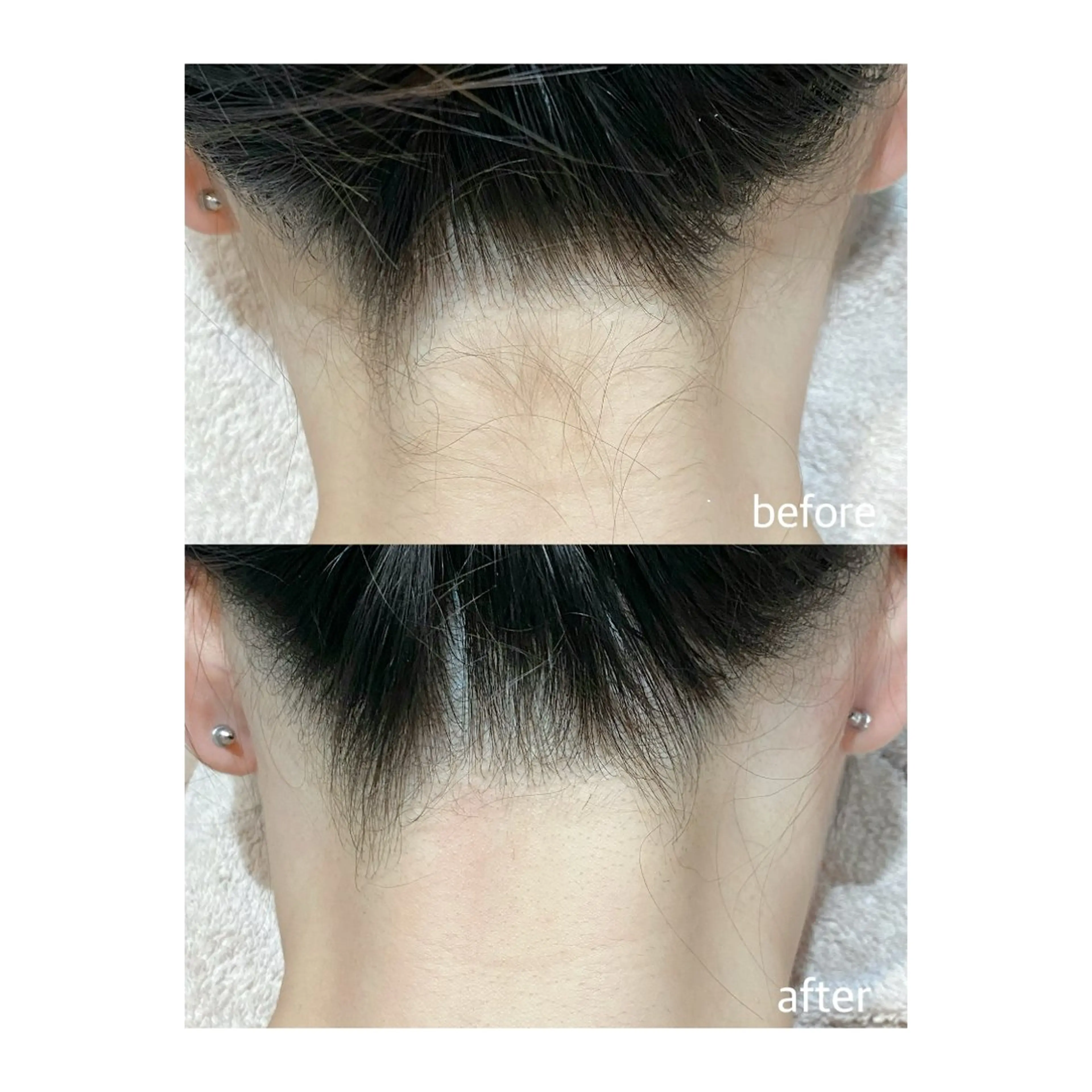 脱毛 M's Style NAIL BARのエステ・リラクイメージ