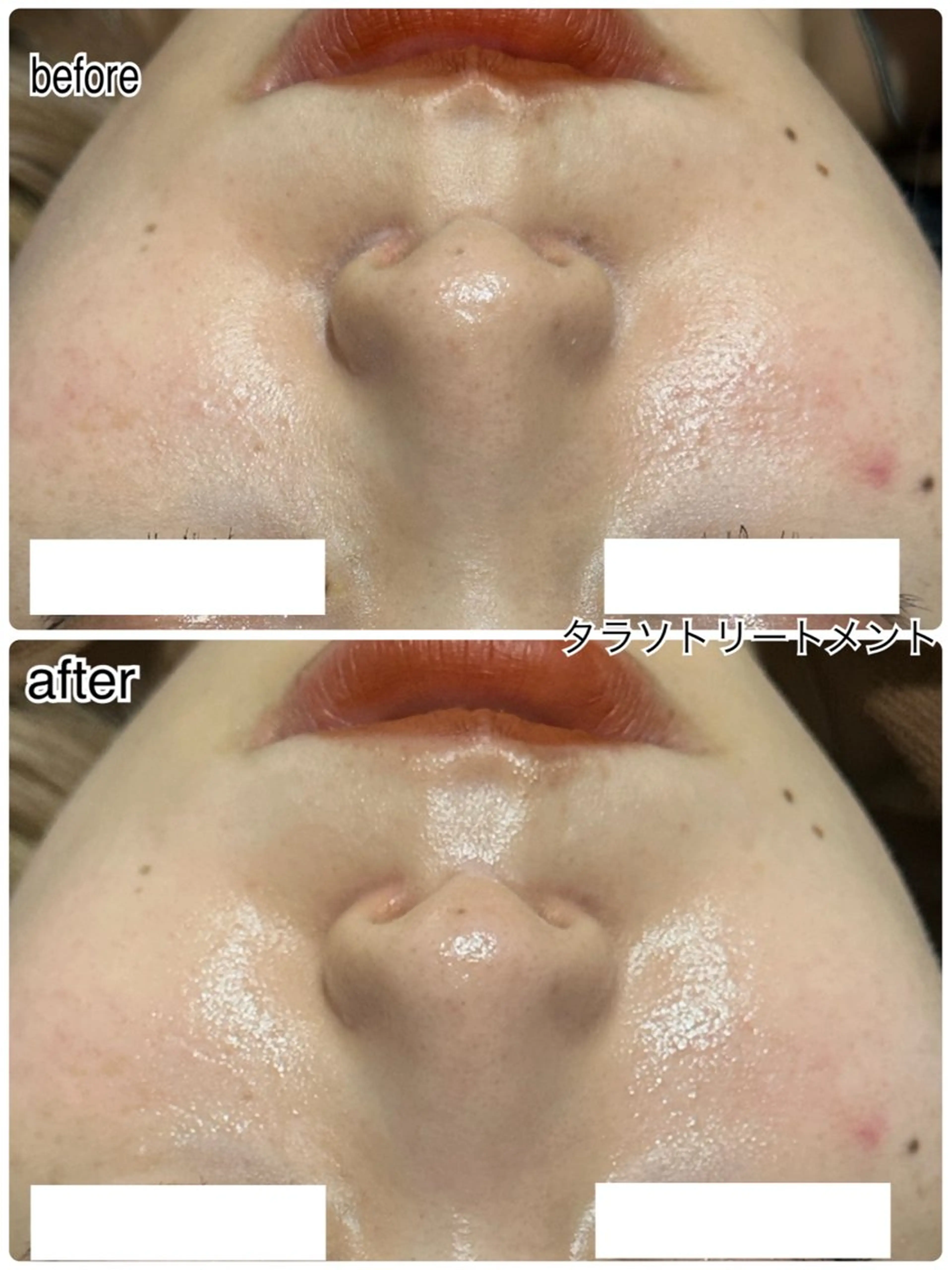 その他 ENCHANT 脱毛.小顔.毛穴のエステ・リラクイメージ