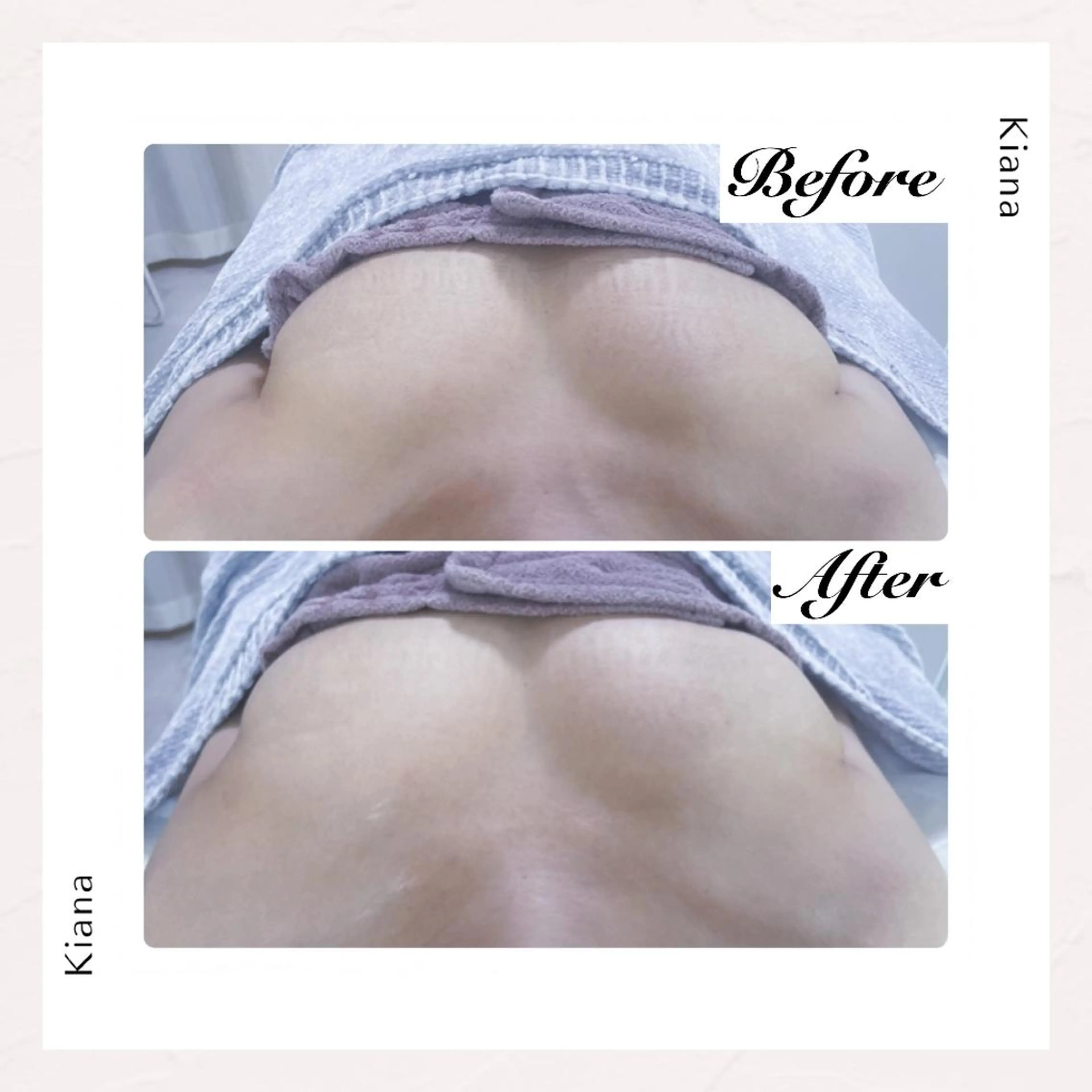 【バスト専門店 】 Kiana のエステ・リラクイメージ