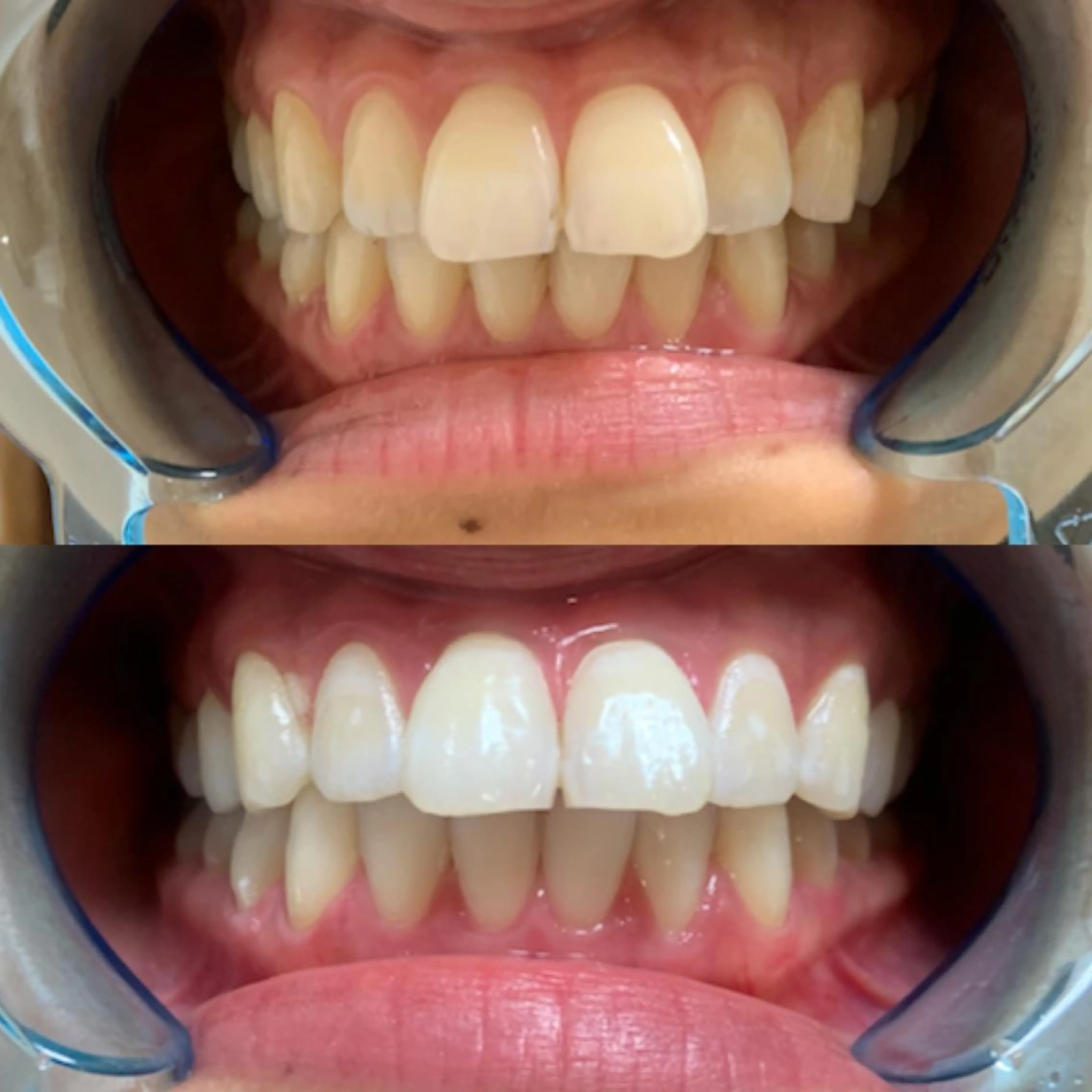 その他 藤本 真心のネイルデザイン