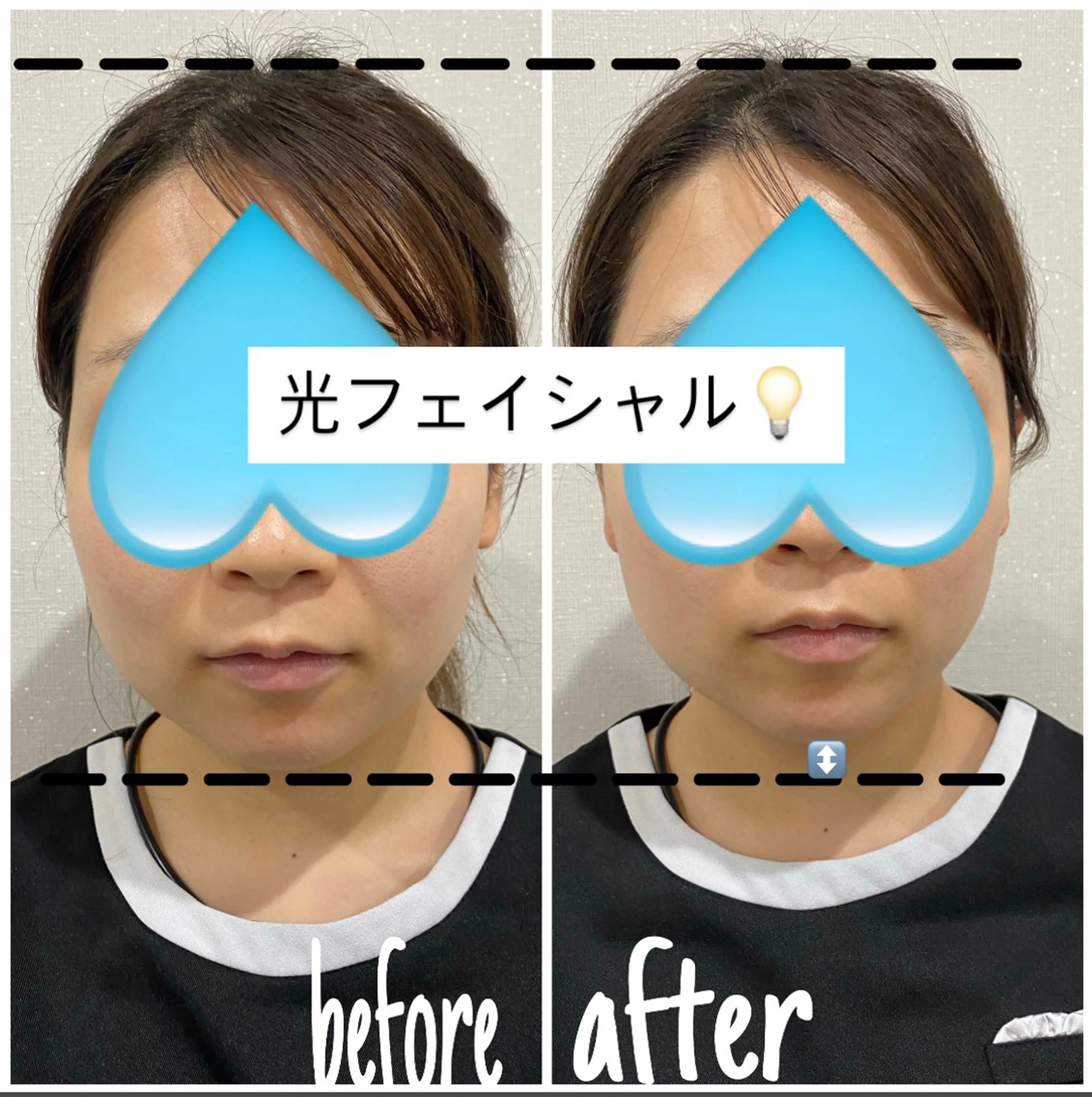 その他 毛穴洗浄・痩身・脱毛 /アルカンジュのエステ・リラクイメージ