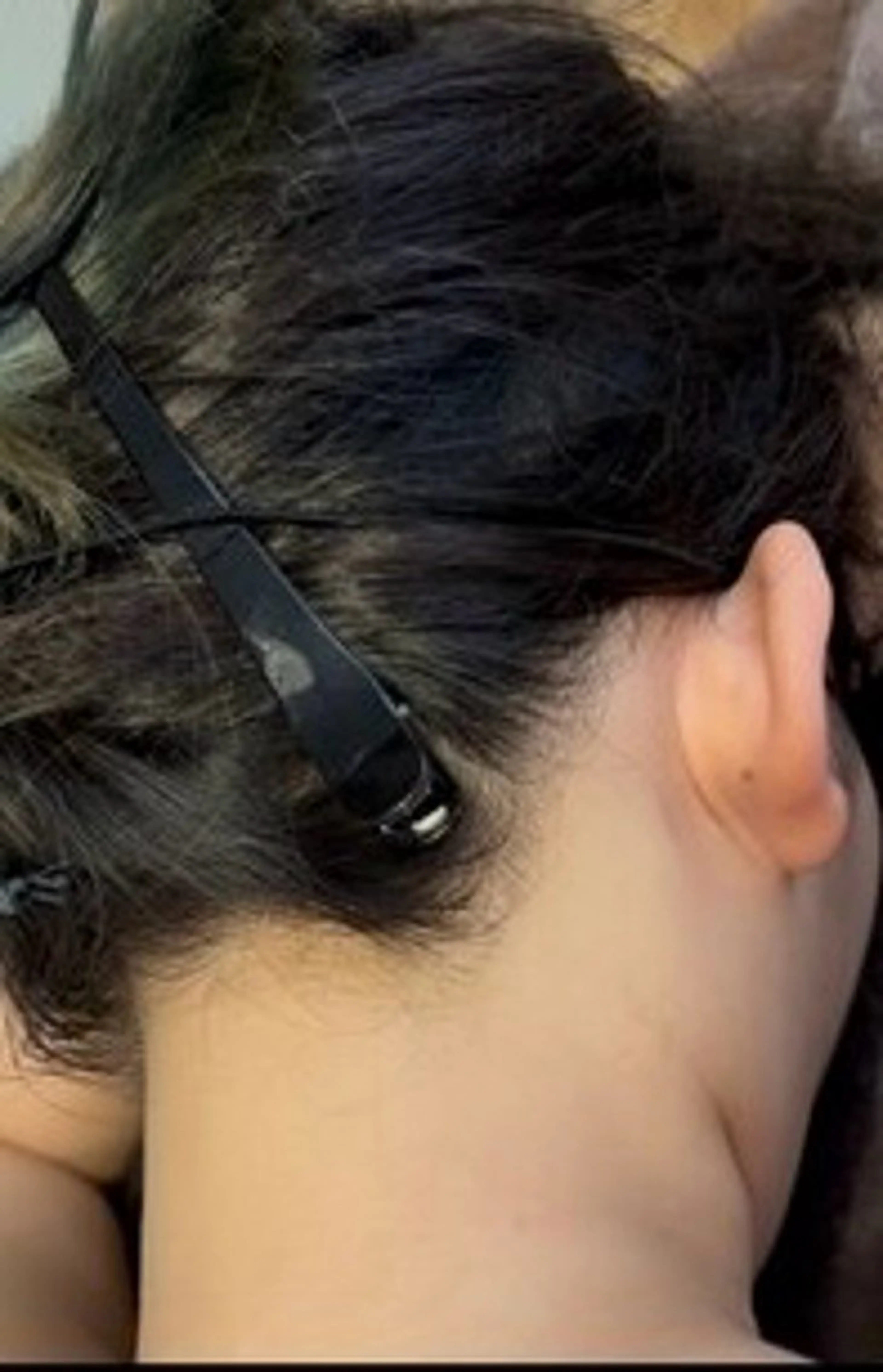 うなじスッキリ♡waxか光選べる脱毛🌸の写真