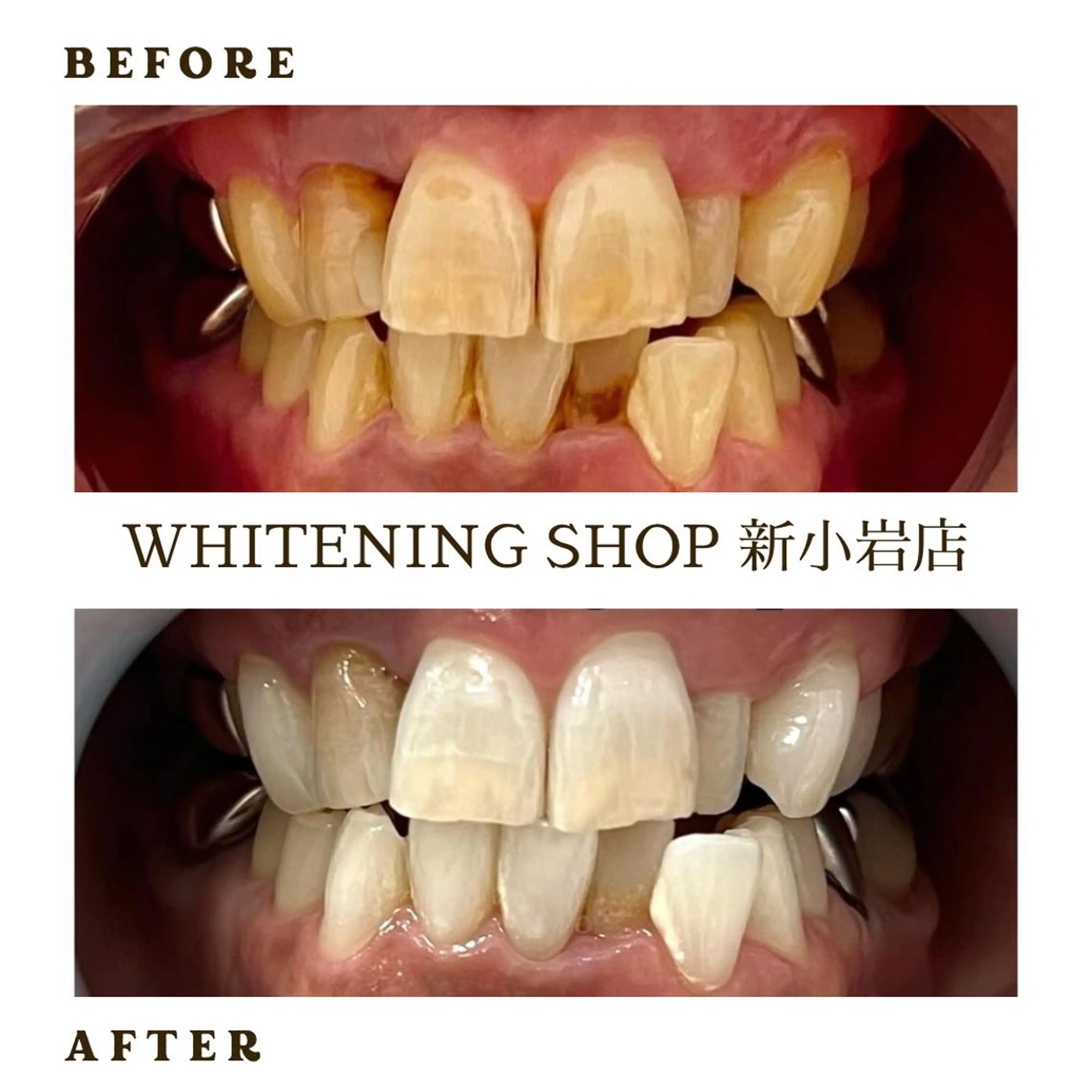メンズ その他 ホワイトニング ショップ新小岩店のその他イメージ