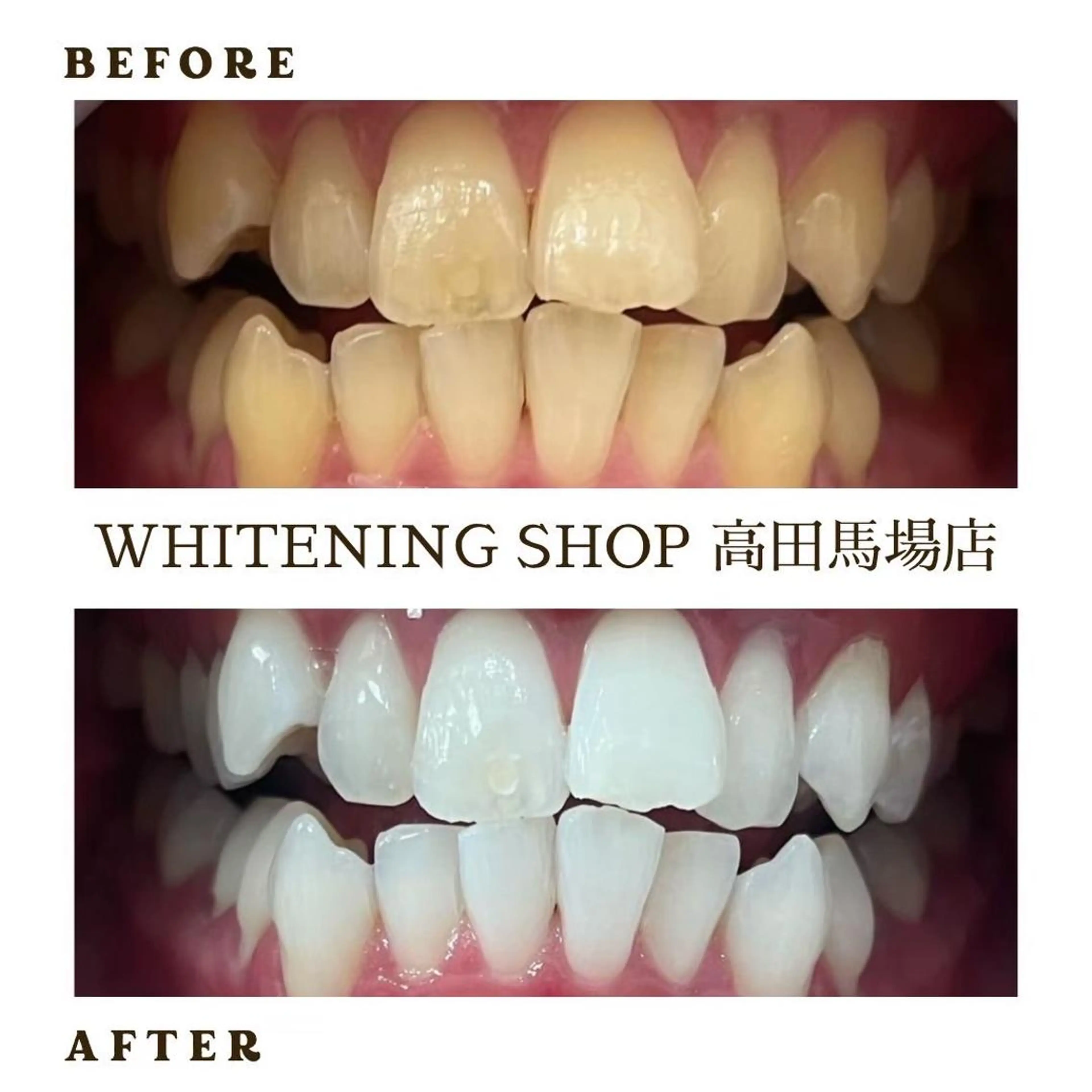 メンズ 学生（メンズ向け） その他 ホワイトニング ショップ高田馬場店のその他イメージ