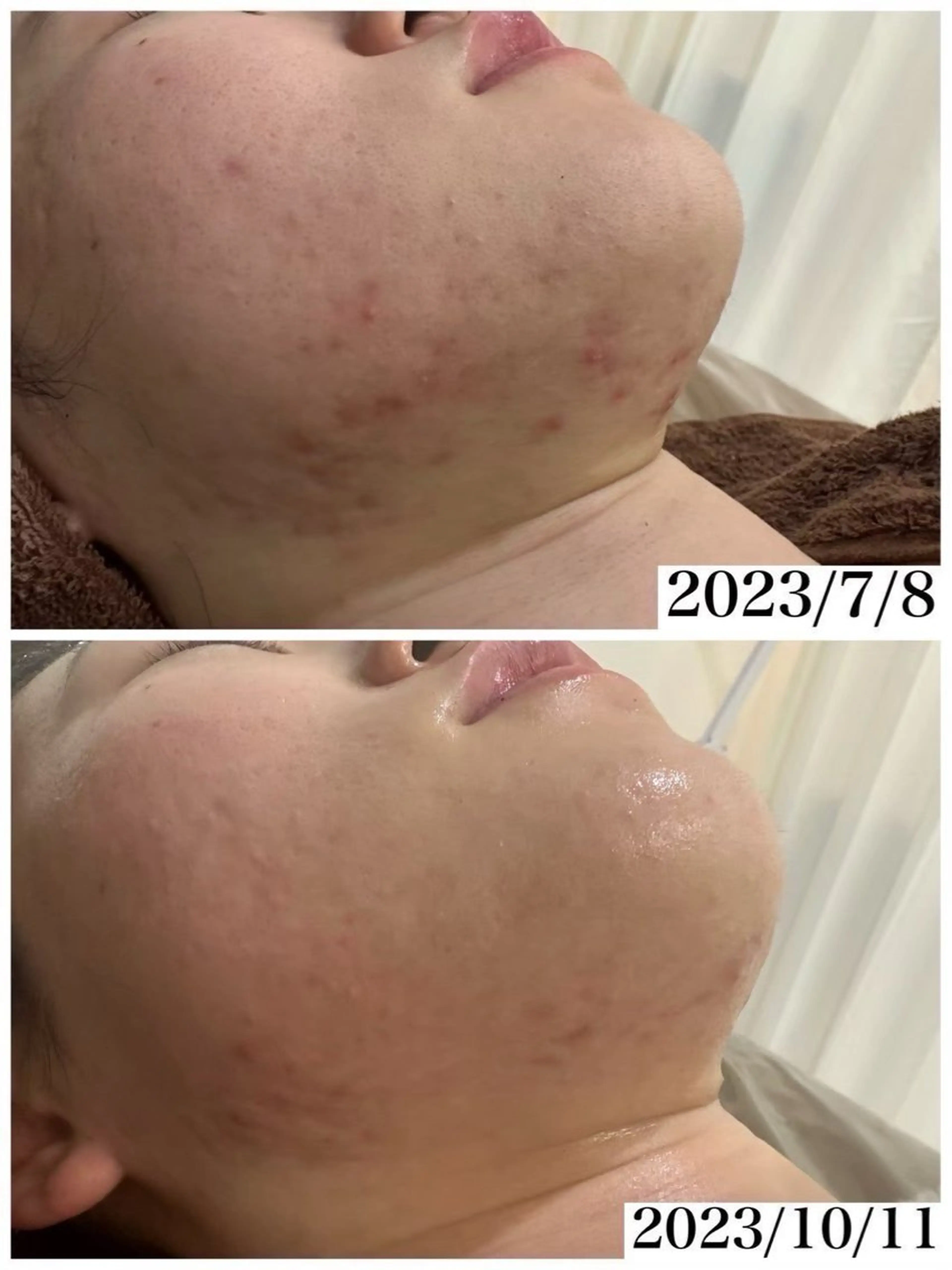 ハーブピーリング/ ララピール専門店のエステ・リラクイメージ