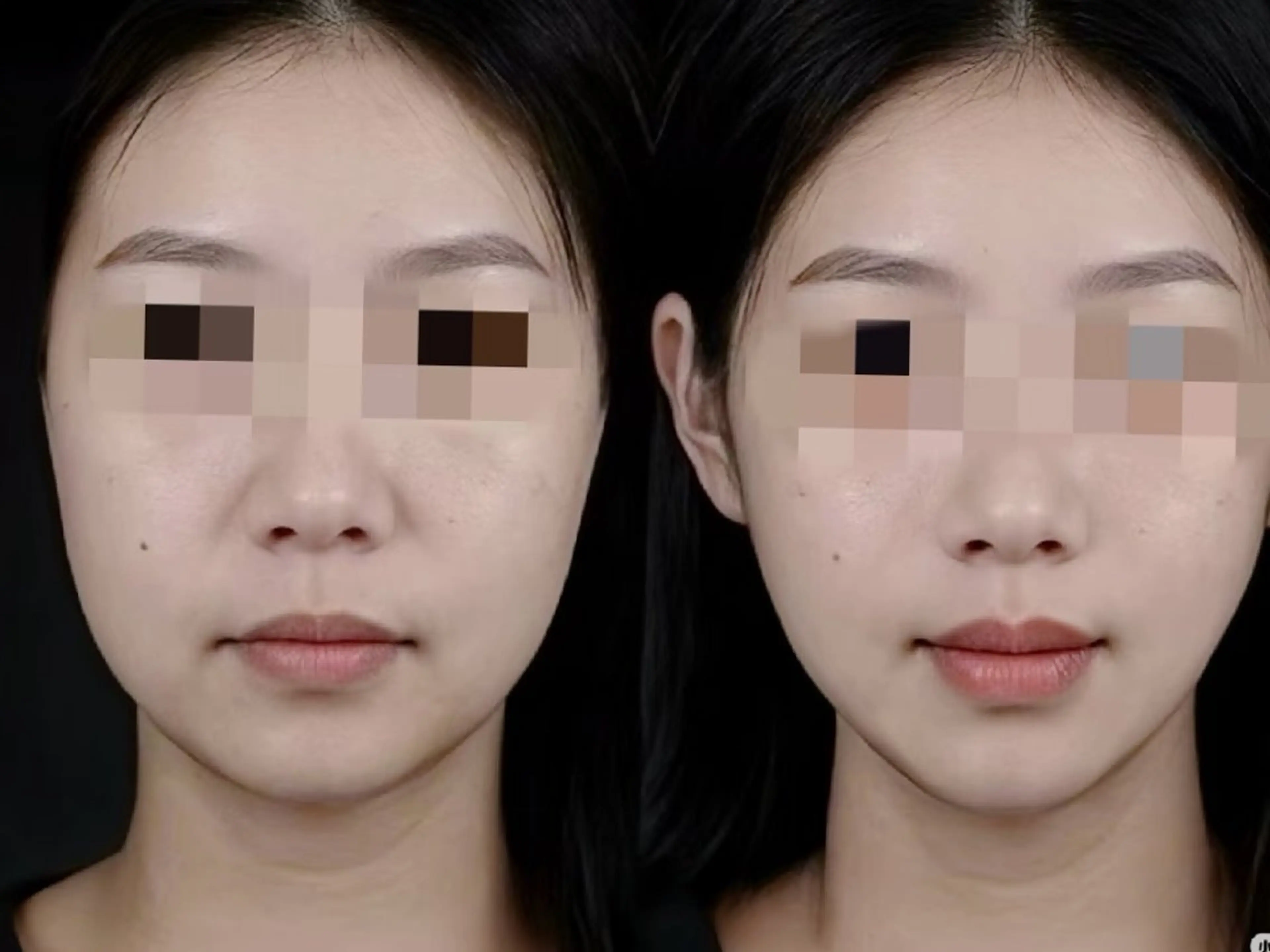 エステ aliaハイフ&水光ジェットサロン所属・aliaハーブ水光店 エステティシャン募集のエステ・リラクイメージ