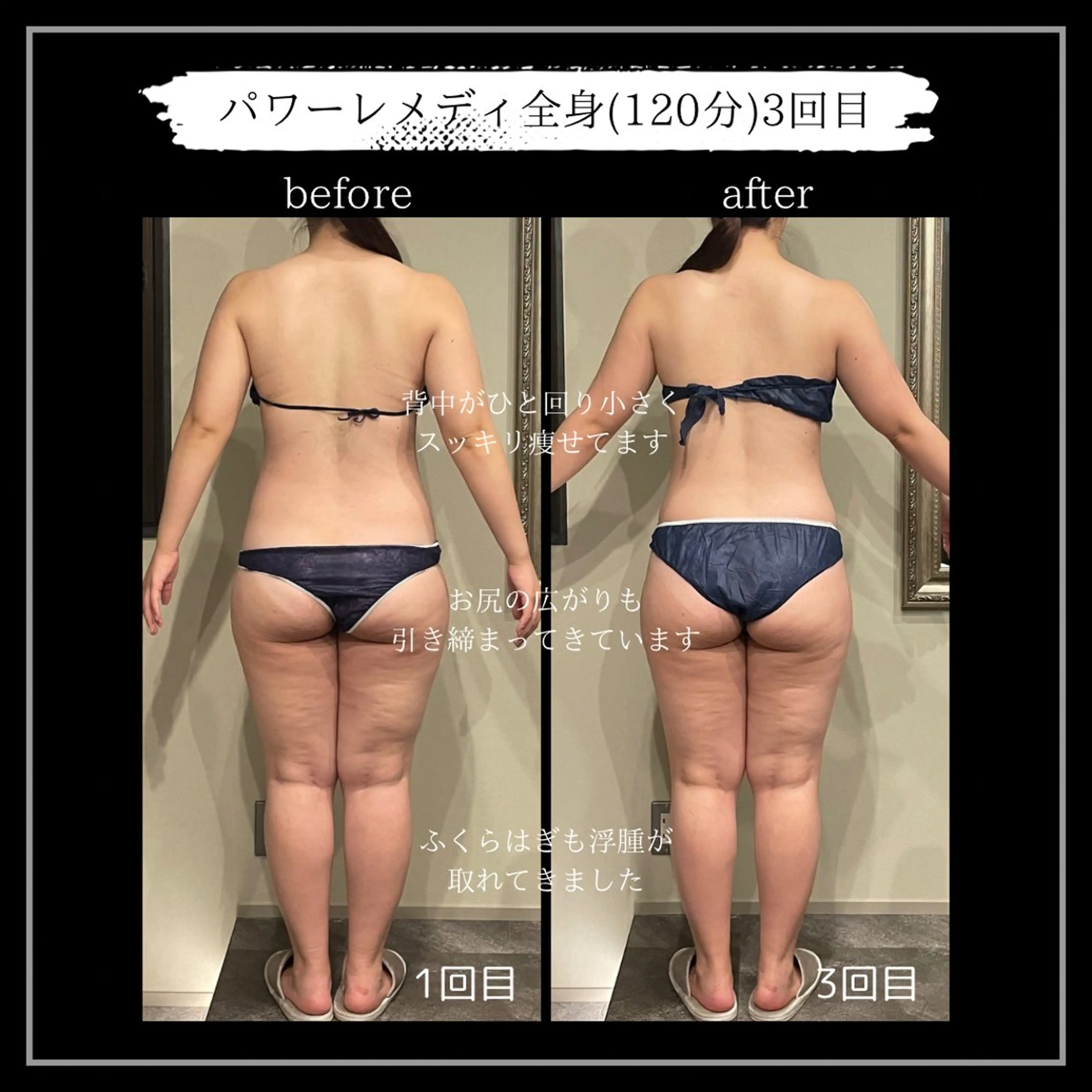 オフ:オン所属・オフ:オン 全身筋膜マッサージのエステ・リラクイメージ