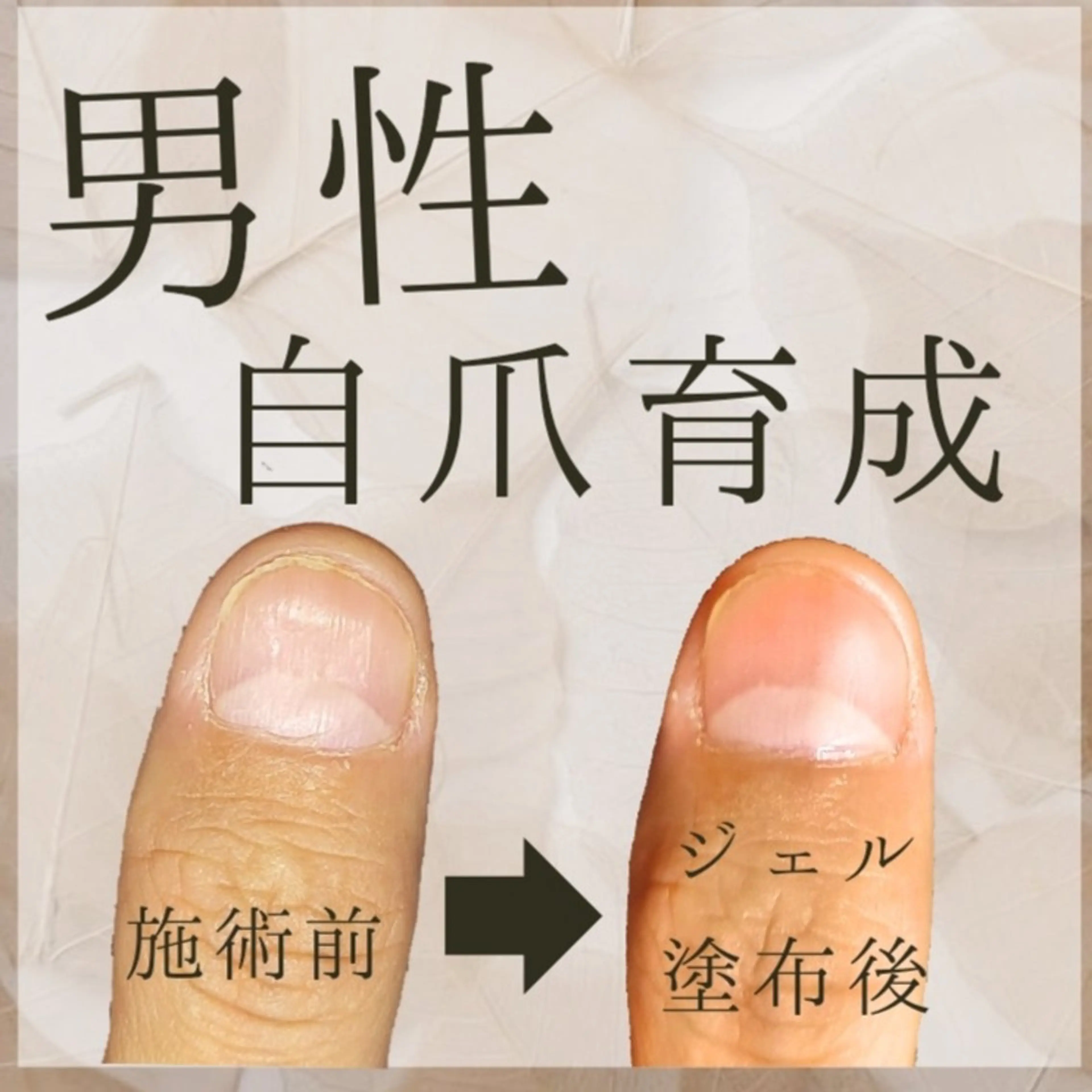 ネイル 【豊中駅徒歩2分】 me+のネイルデザイン