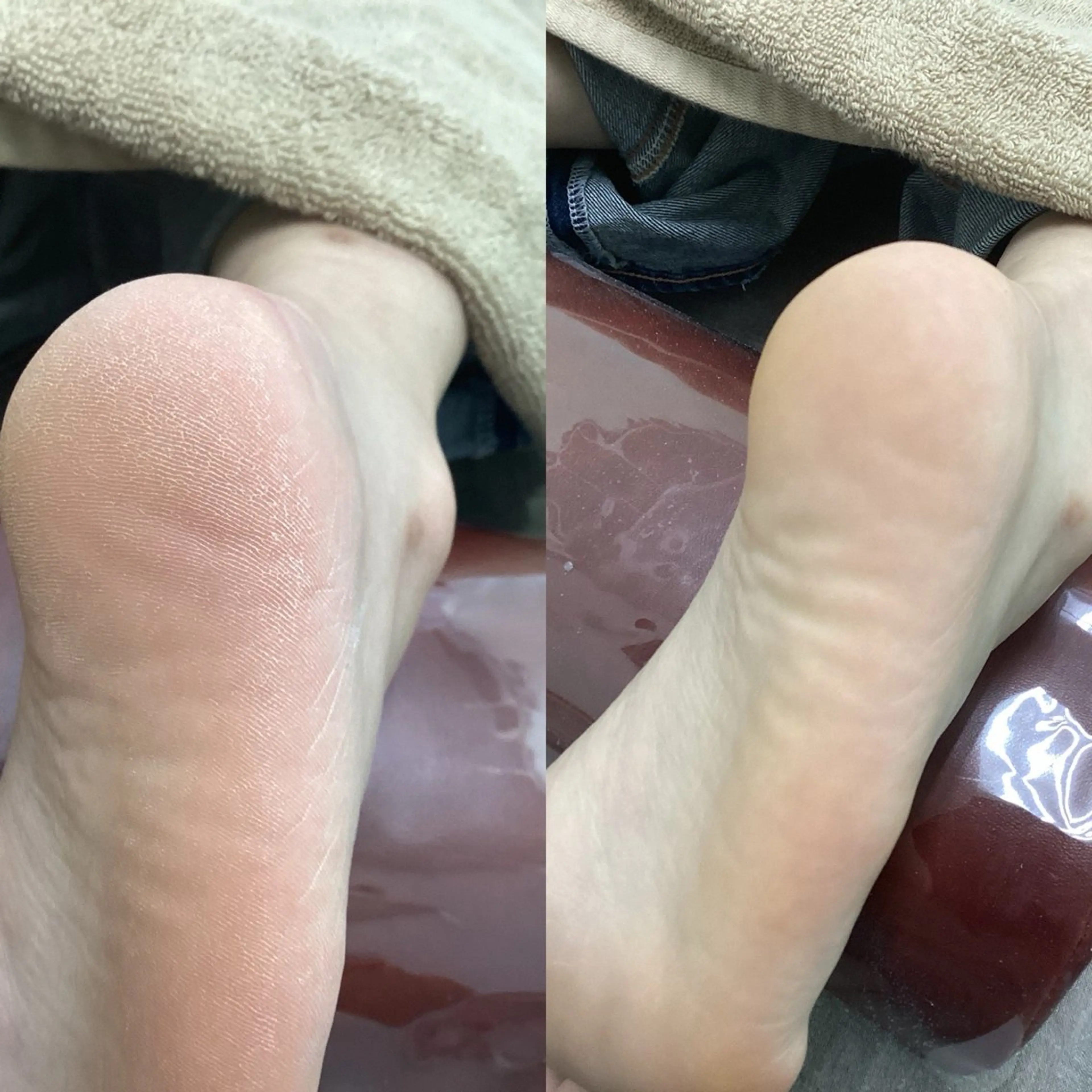 リラク ヒューマン 鍼灸接骨院所属・リラク/ヘッドスパ/ 足裏ケア/蛭川栞のエステ・リラクイメージ