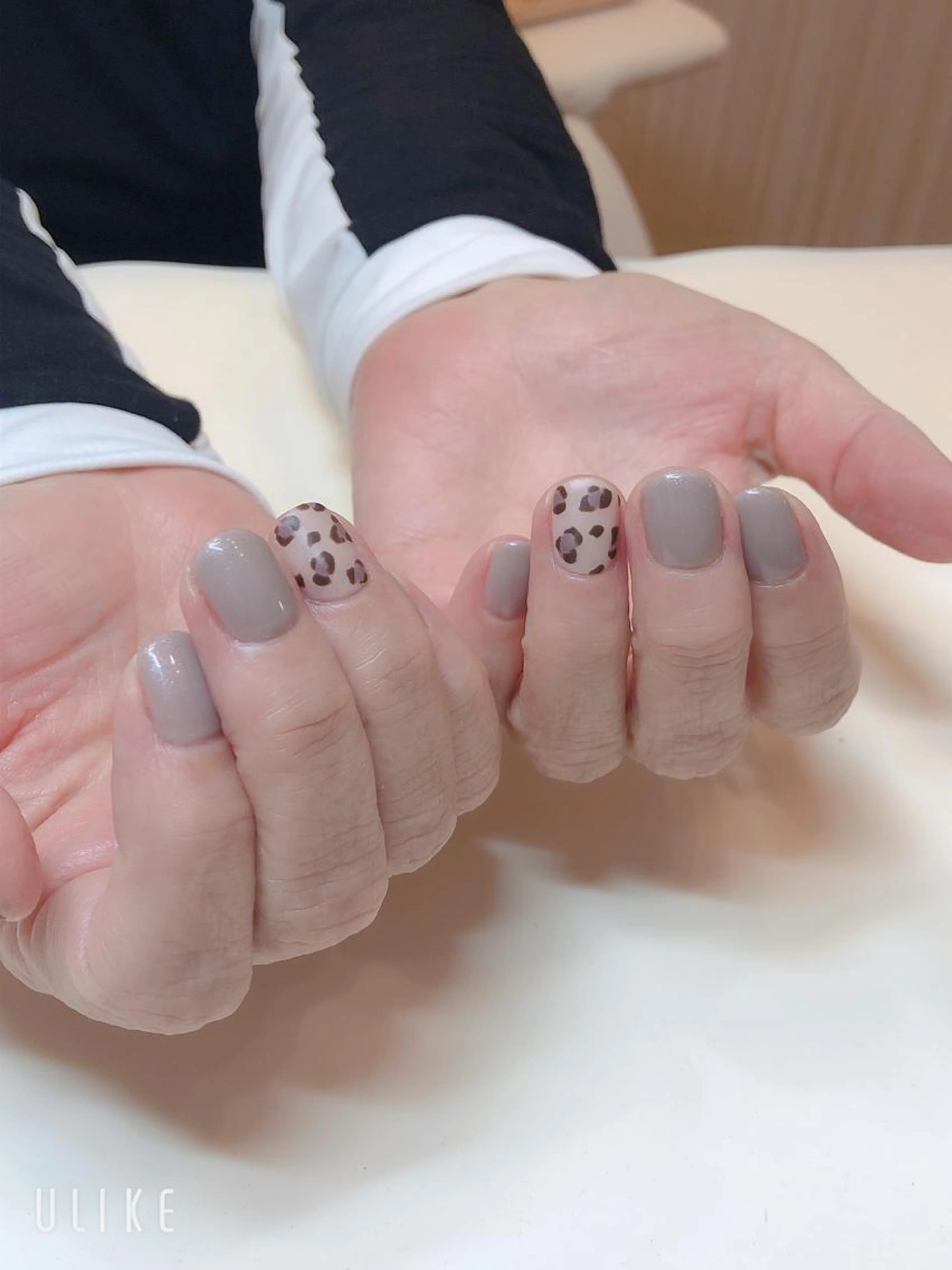 ウォーターケア＋ジェルライトコースの写真