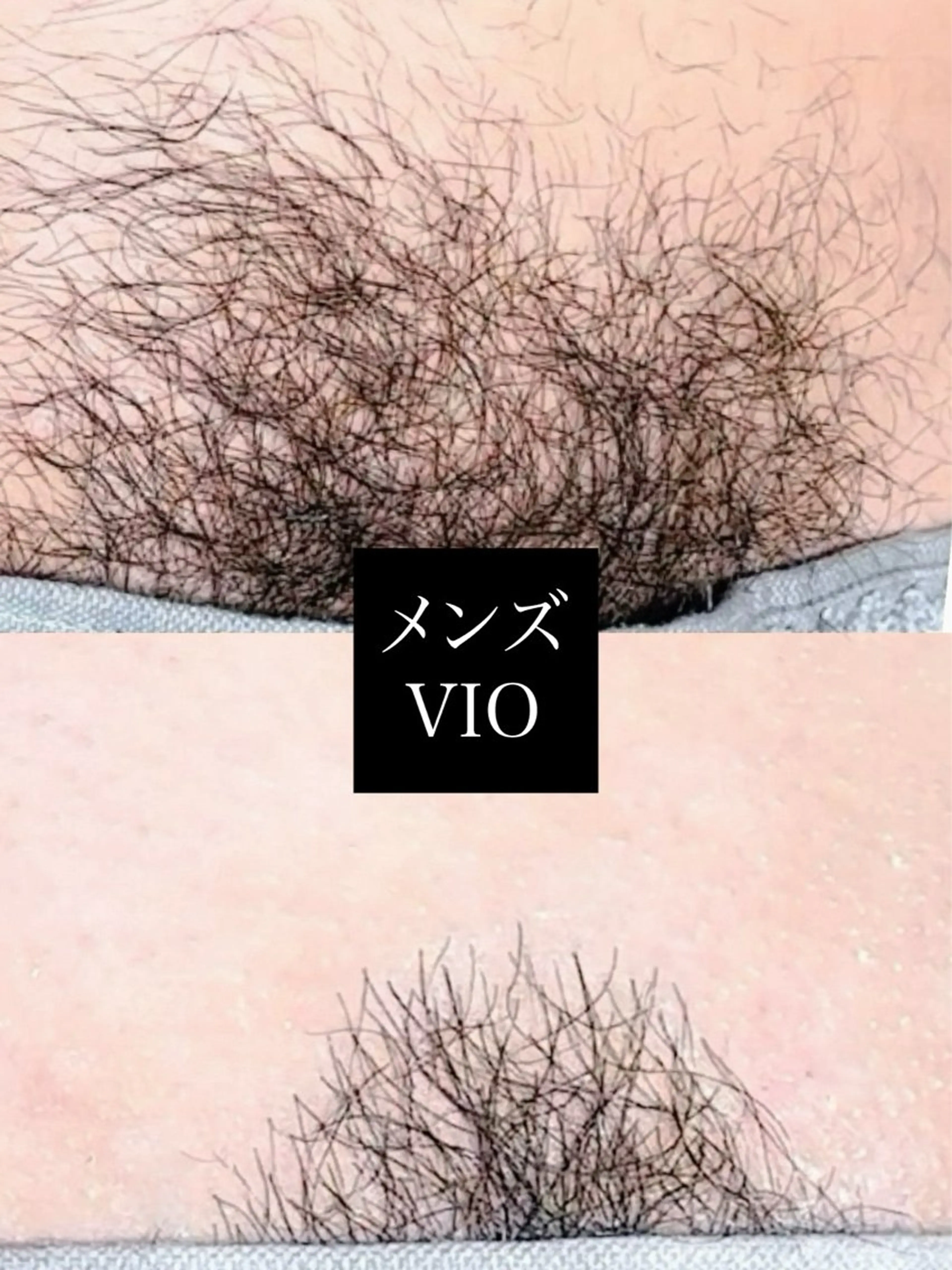 Hit. シュガーリング豊橋のエステ・リラクイメージ