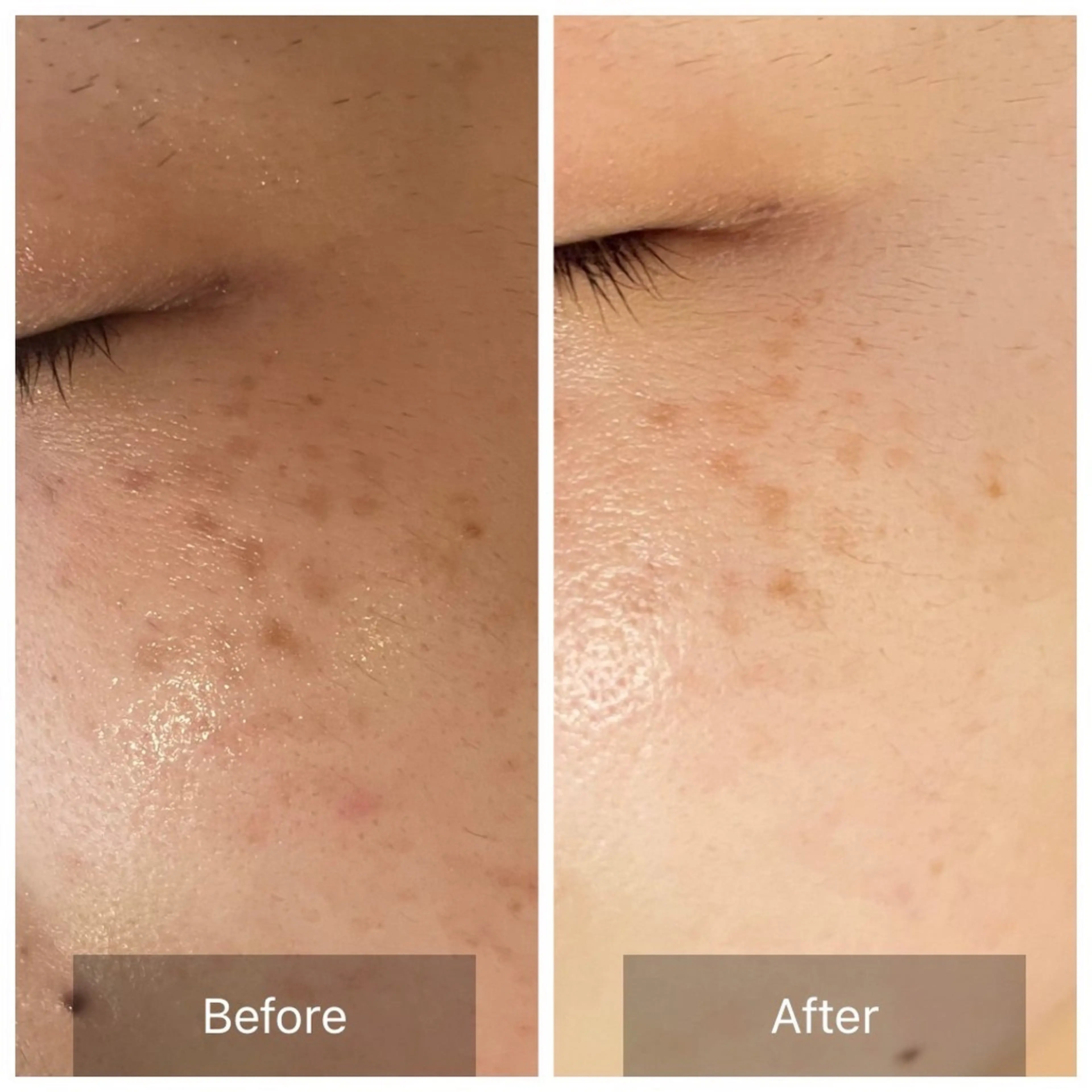 〈etre〉トータルビューティーサロン所属・etre - 韓国肌管理 -のエステ・リラクイメージ