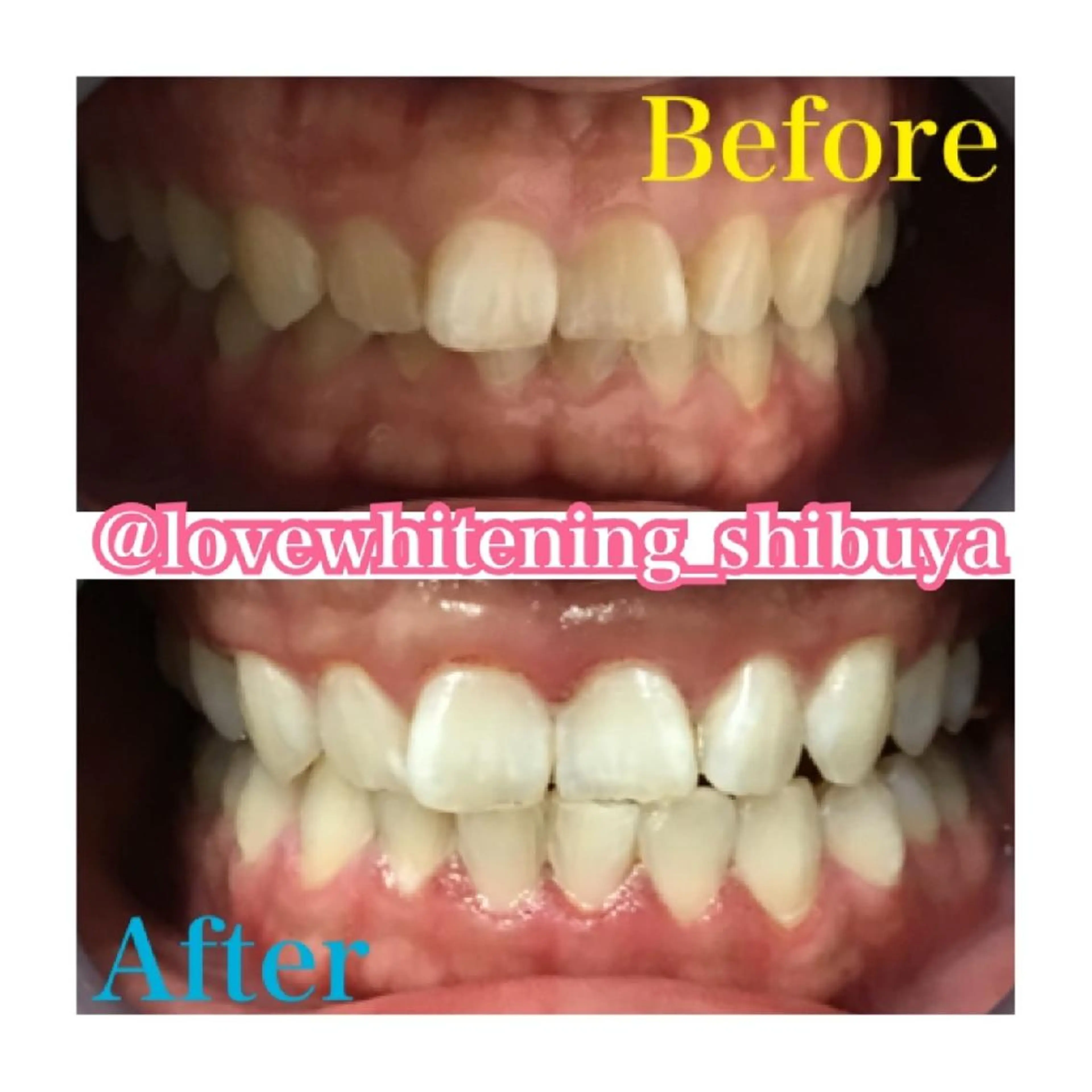 LOVE ホワイトニング渋谷のその他イメージ