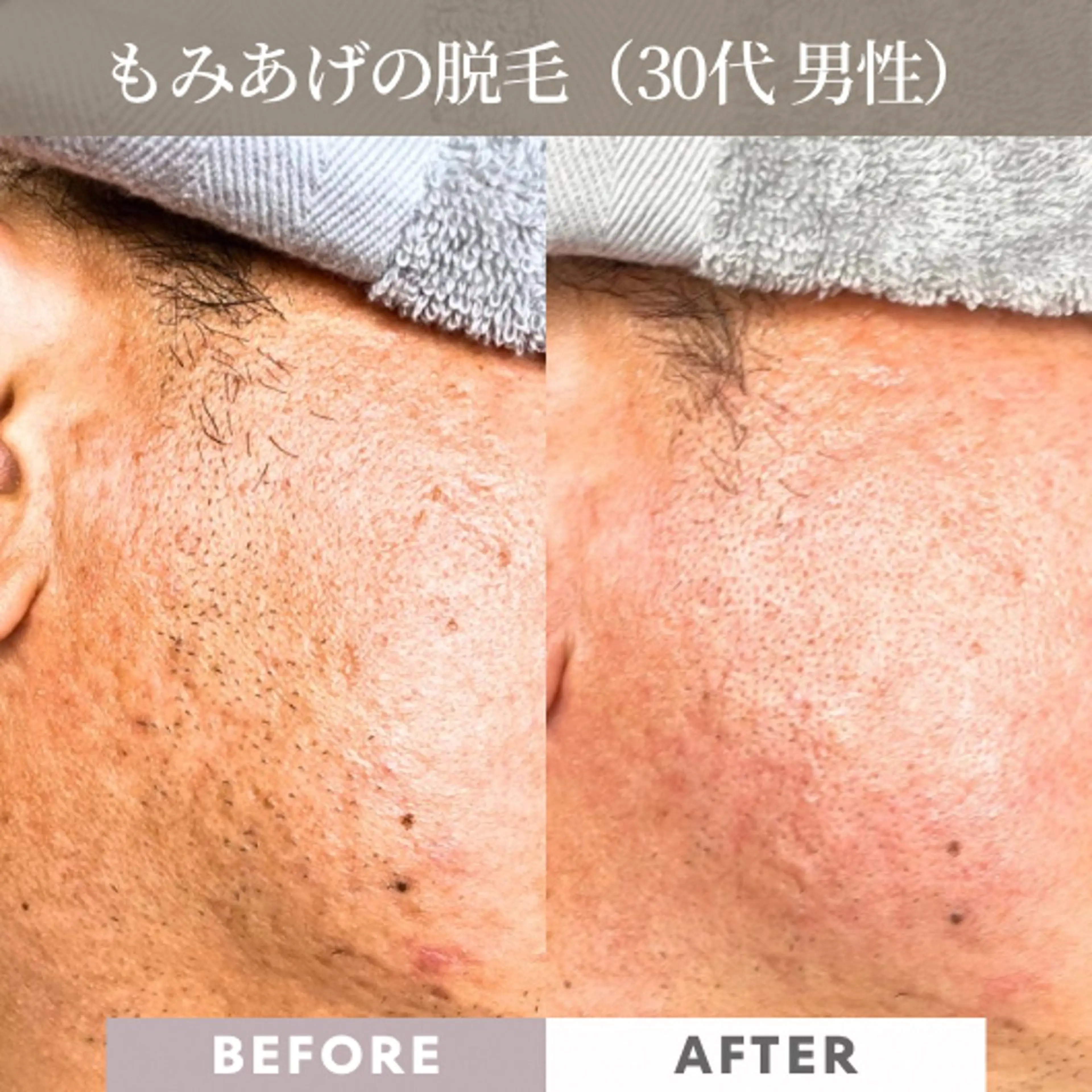 メンズ 美容電気脱毛サロン ReMoveリムーブのエステ・リラクイメージ