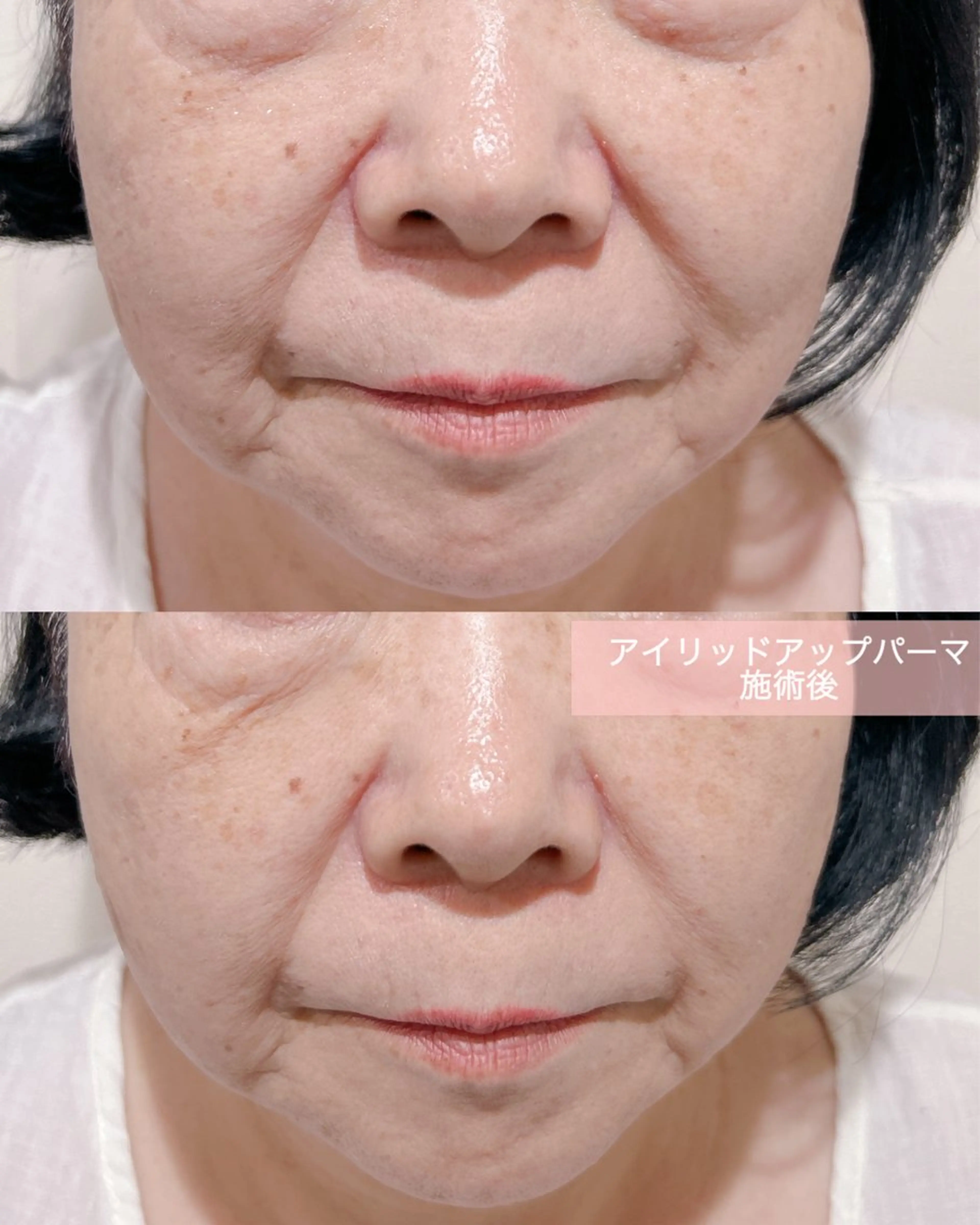 マツエク・マツパ アイリッドアップパーマ 一重×まつ毛パーマ マツパ merveilles所属・まつげ/整体/にきび ・アトピー専門サロンのマツエク・マツパデザイン