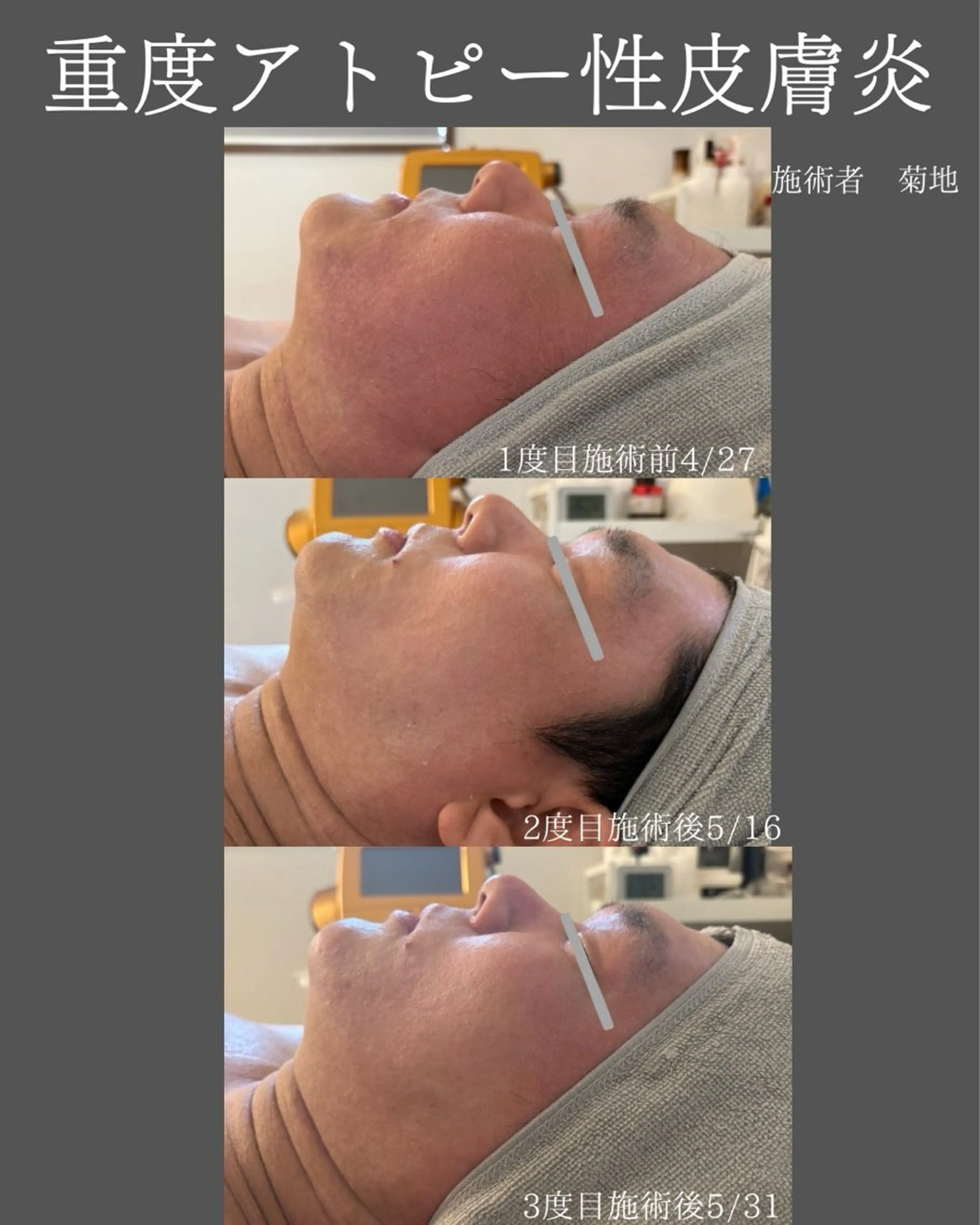 BLOSSOM 菊地のエステ・リラクイメージ