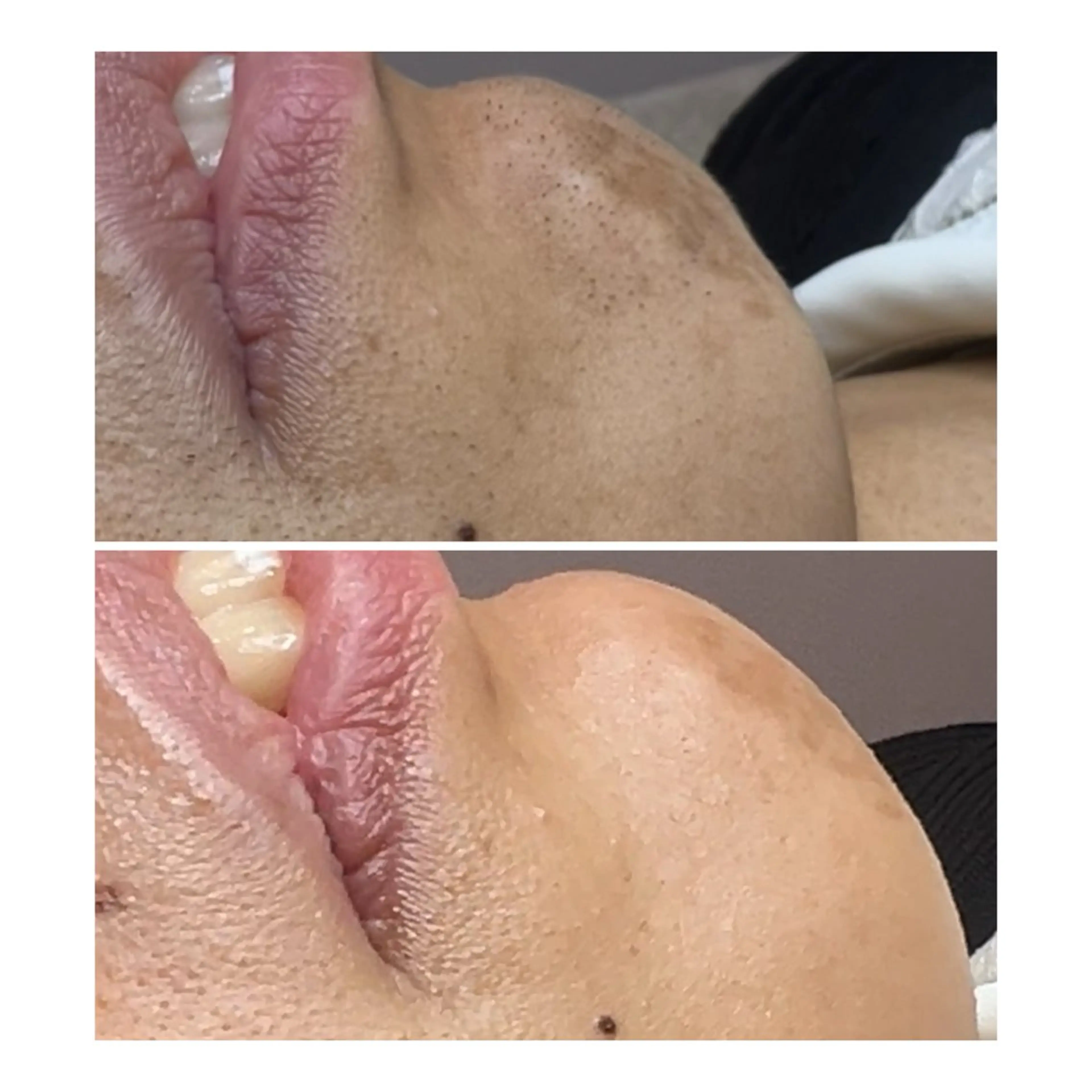 脱毛 WHITEWAX ホワイトワックスのエステ・リラクイメージ