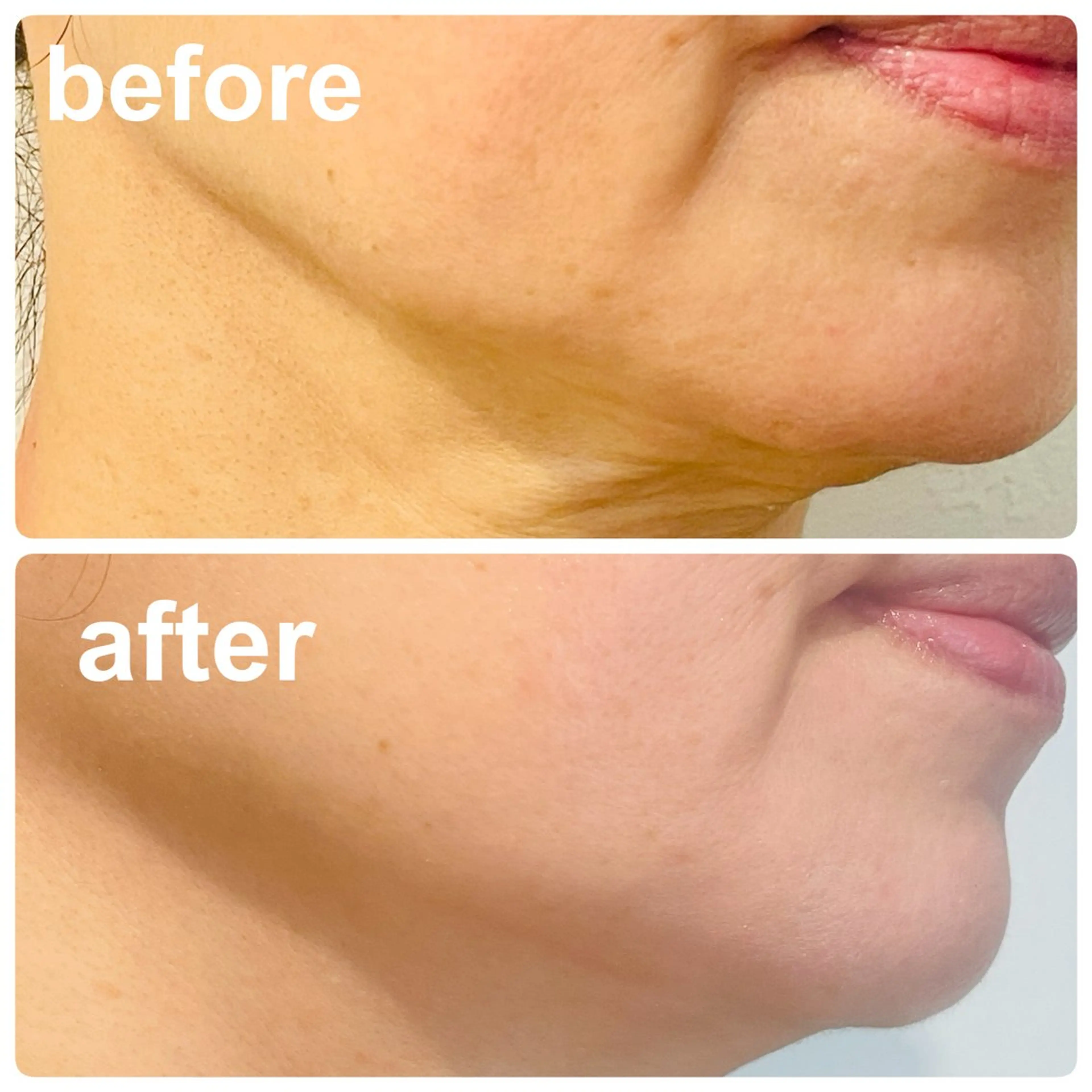 POLA 北花田店のエステ・リラクイメージ