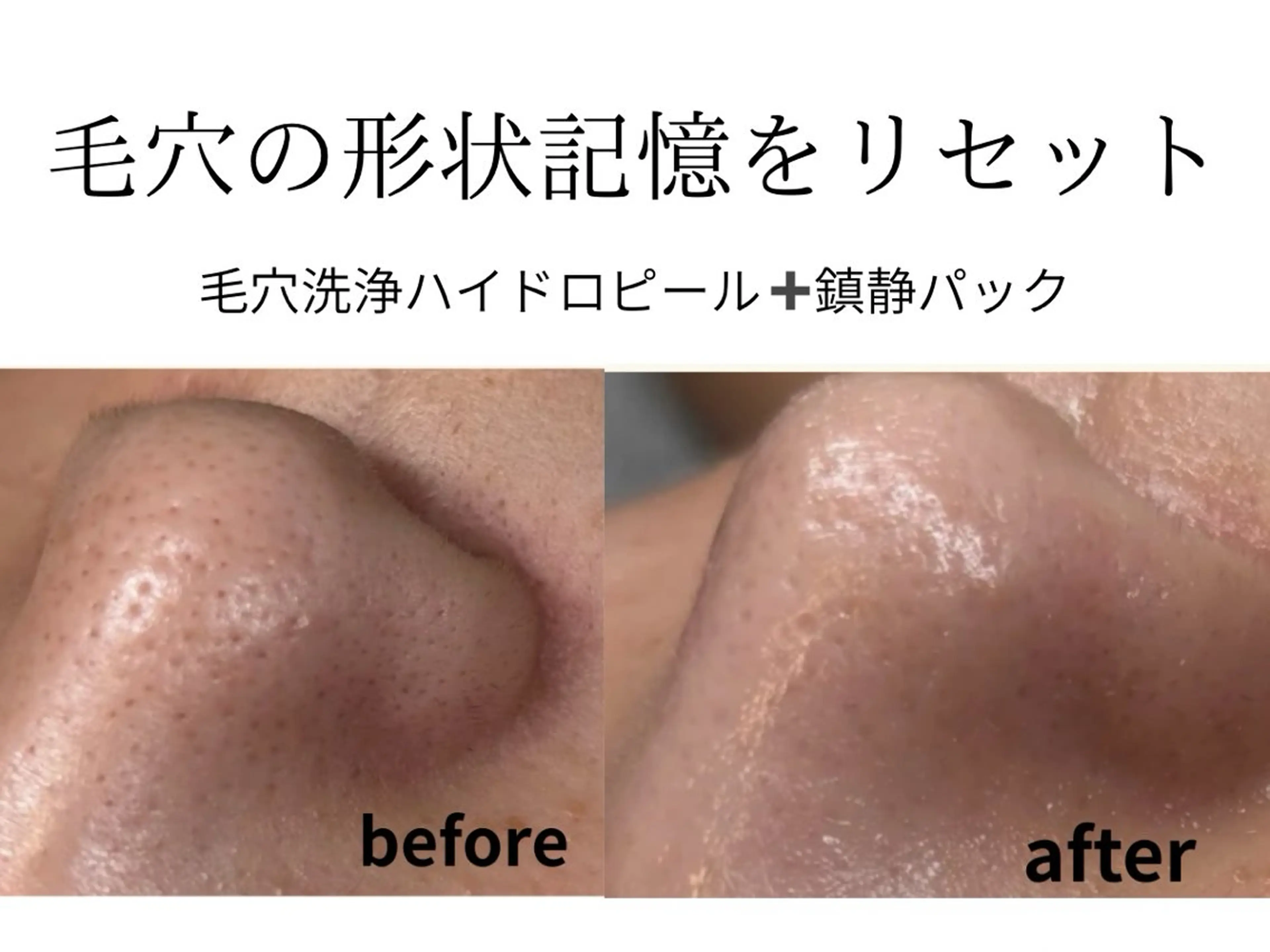 その他 Salon【yuzu.】所属・🍊肌管理×美眉 【yuzu.】の眉毛・アイブロウイメージ