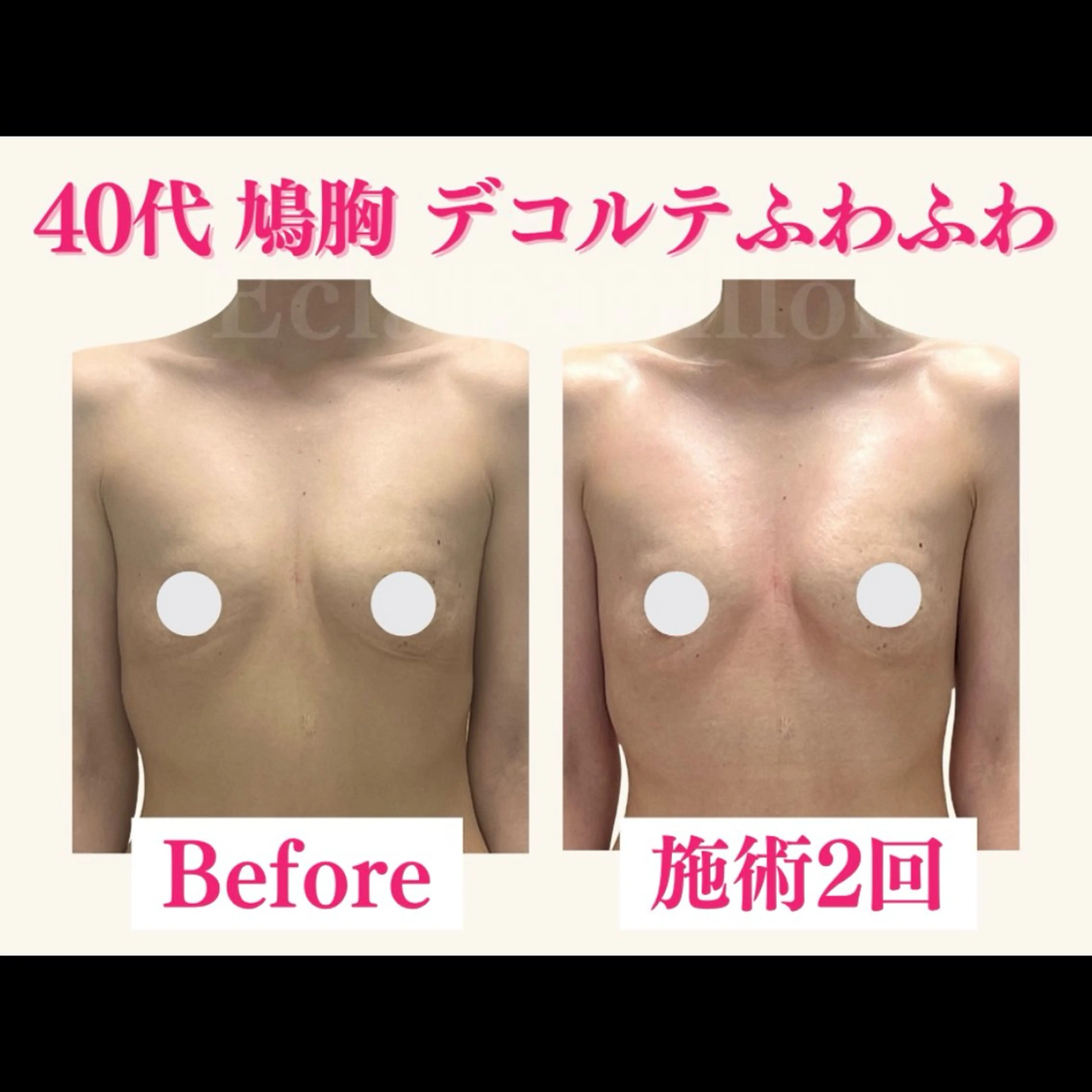 エステ リラク エクラパピヨン バストアップサロンのエステ・リラクイメージ