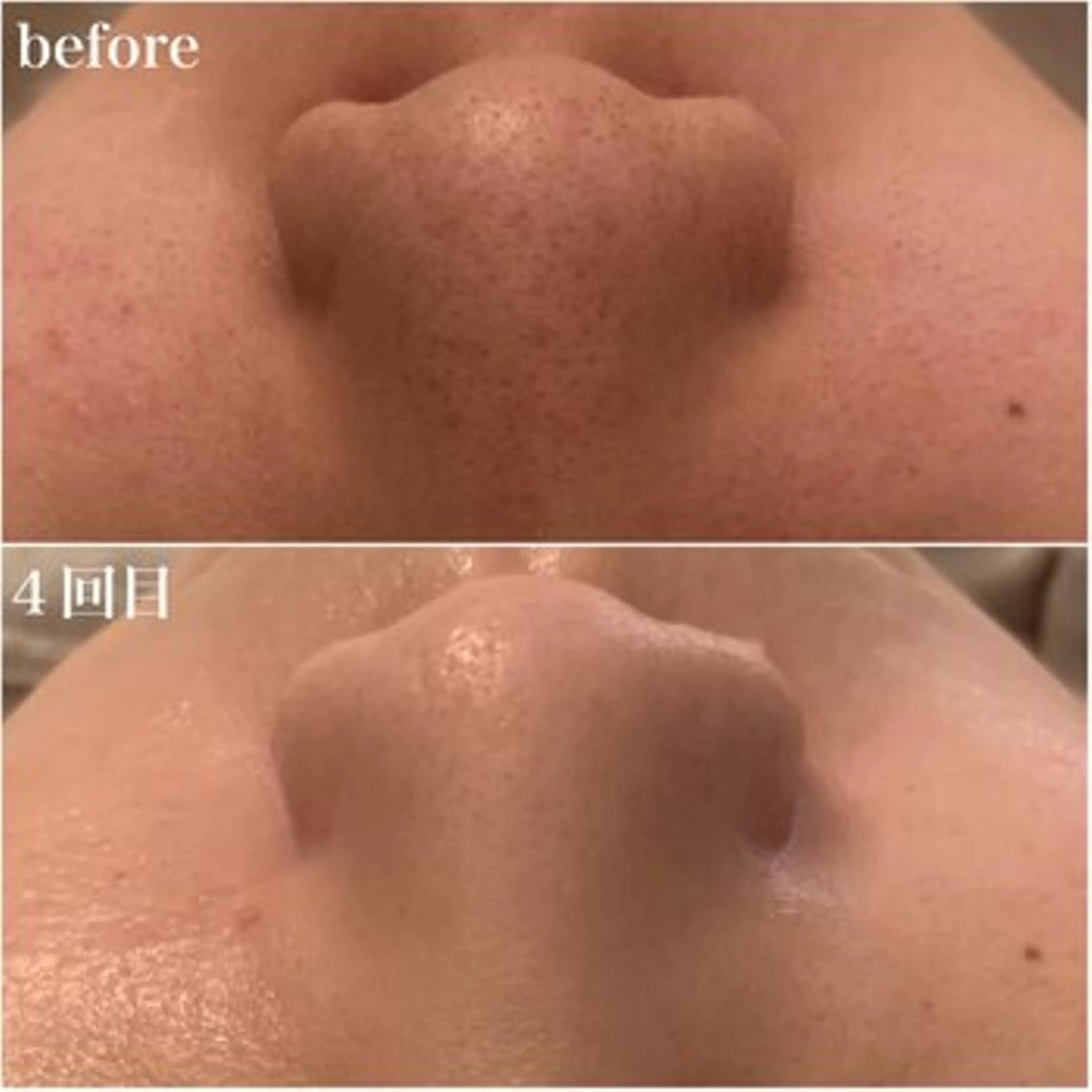 ララ/ハーブ メゾンリュバンのエステ・リラクイメージ