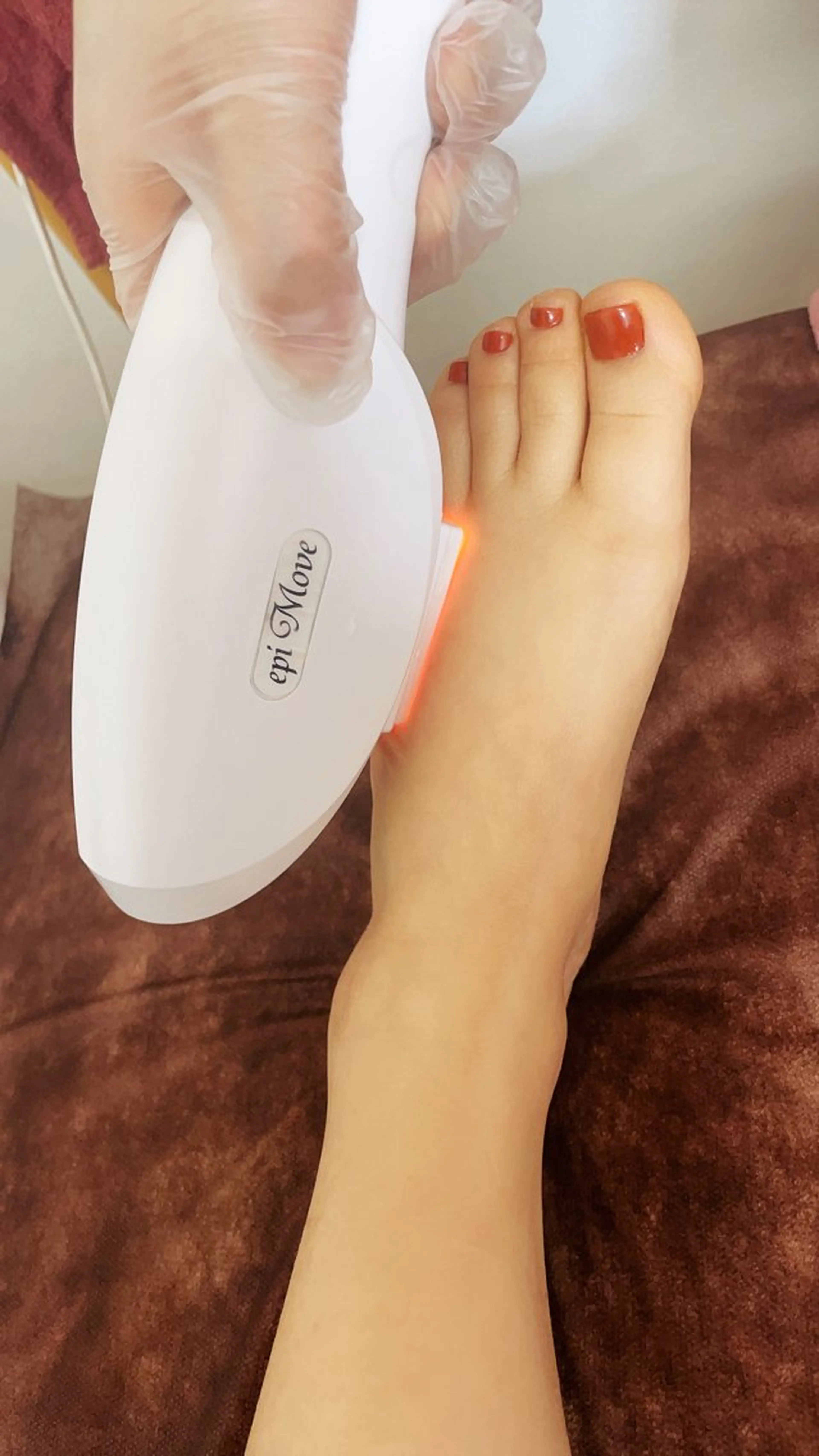 （特別価格50％割引)高速美肌脱毛ー🌸女性のひざ上　（男性の場合は＋1,100円)の写真