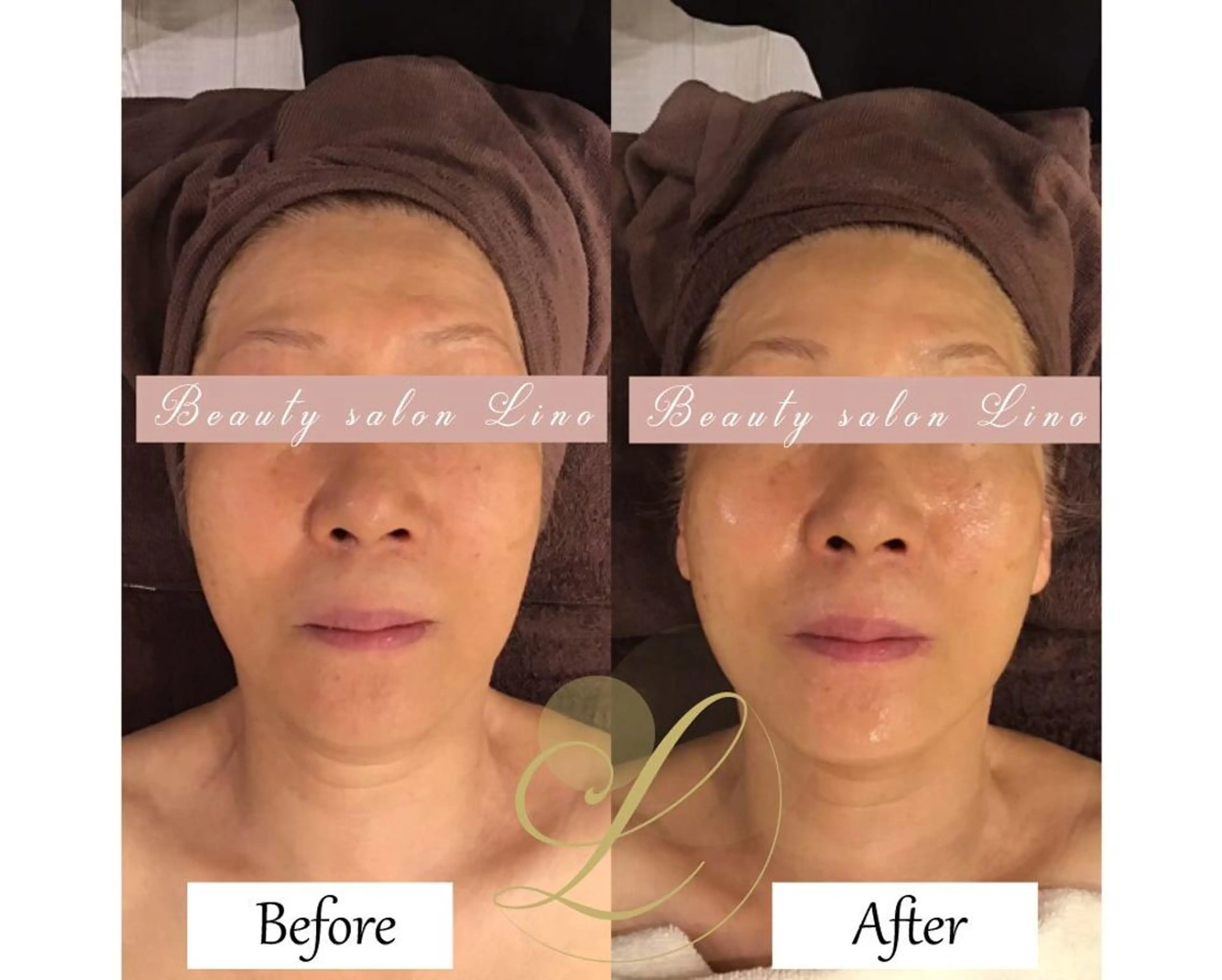 ブライダルサロン ｜Lino【堀江】のエステ・リラクイメージ