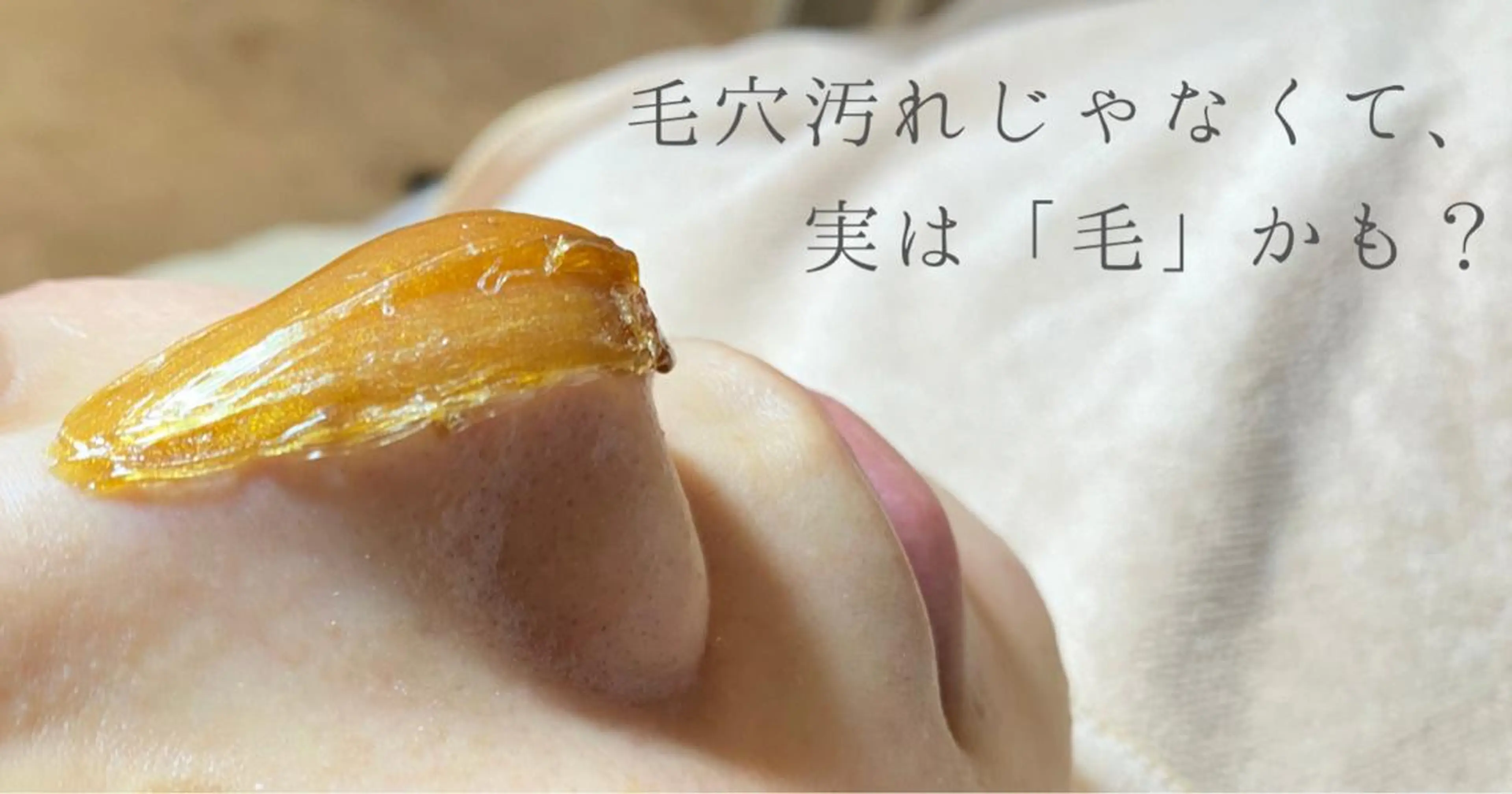 小鼻の黒ずみ集中ケアコース🌸気になる小鼻の黒ずみをピーリングとワックス脱毛、アフターケアのセットでツルツル小鼻へ‼️の写真