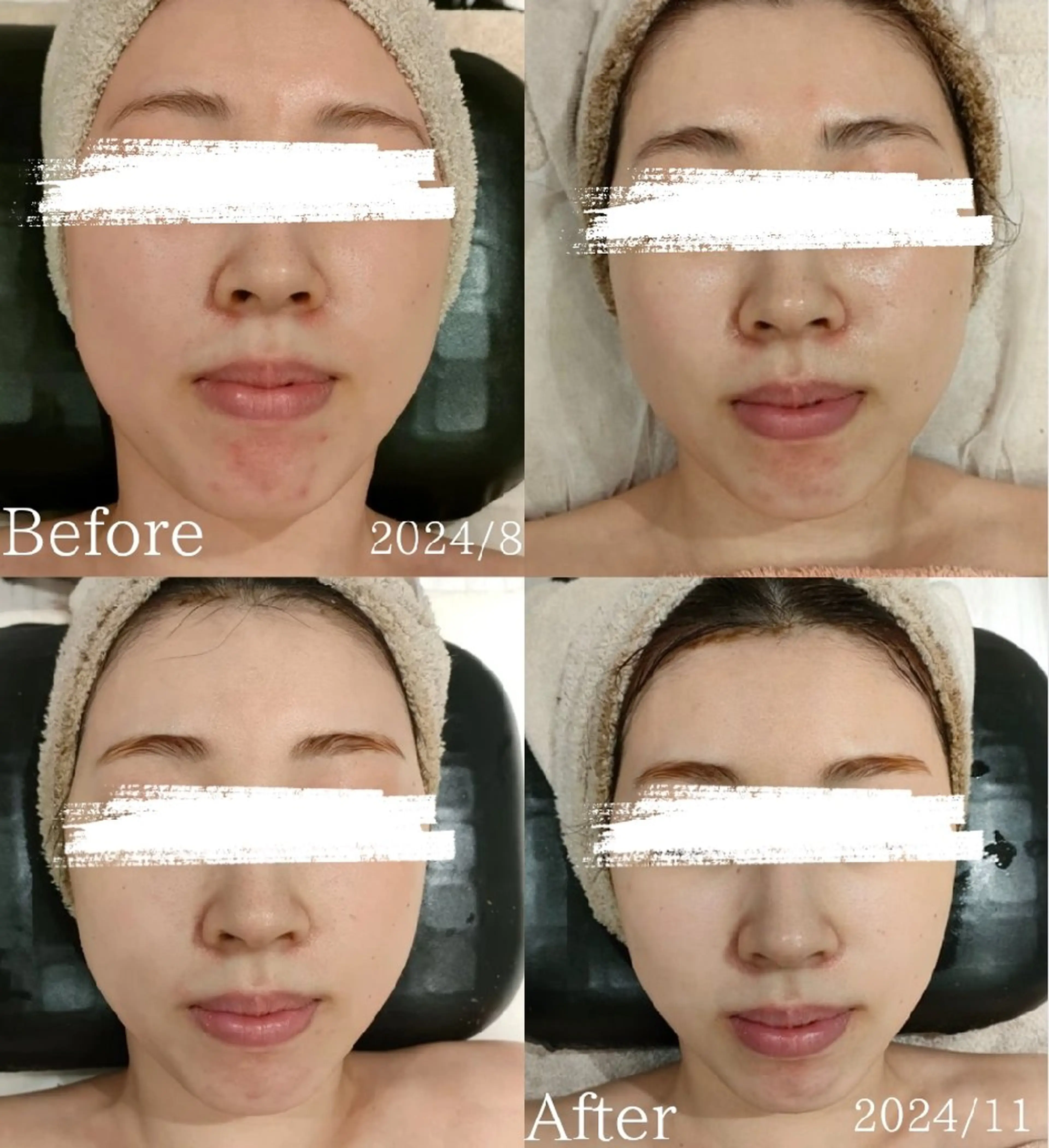 エステ リラク 美肌脱毛＆小顔・フェ イシャル【SONA】のエステ・リラクイメージ