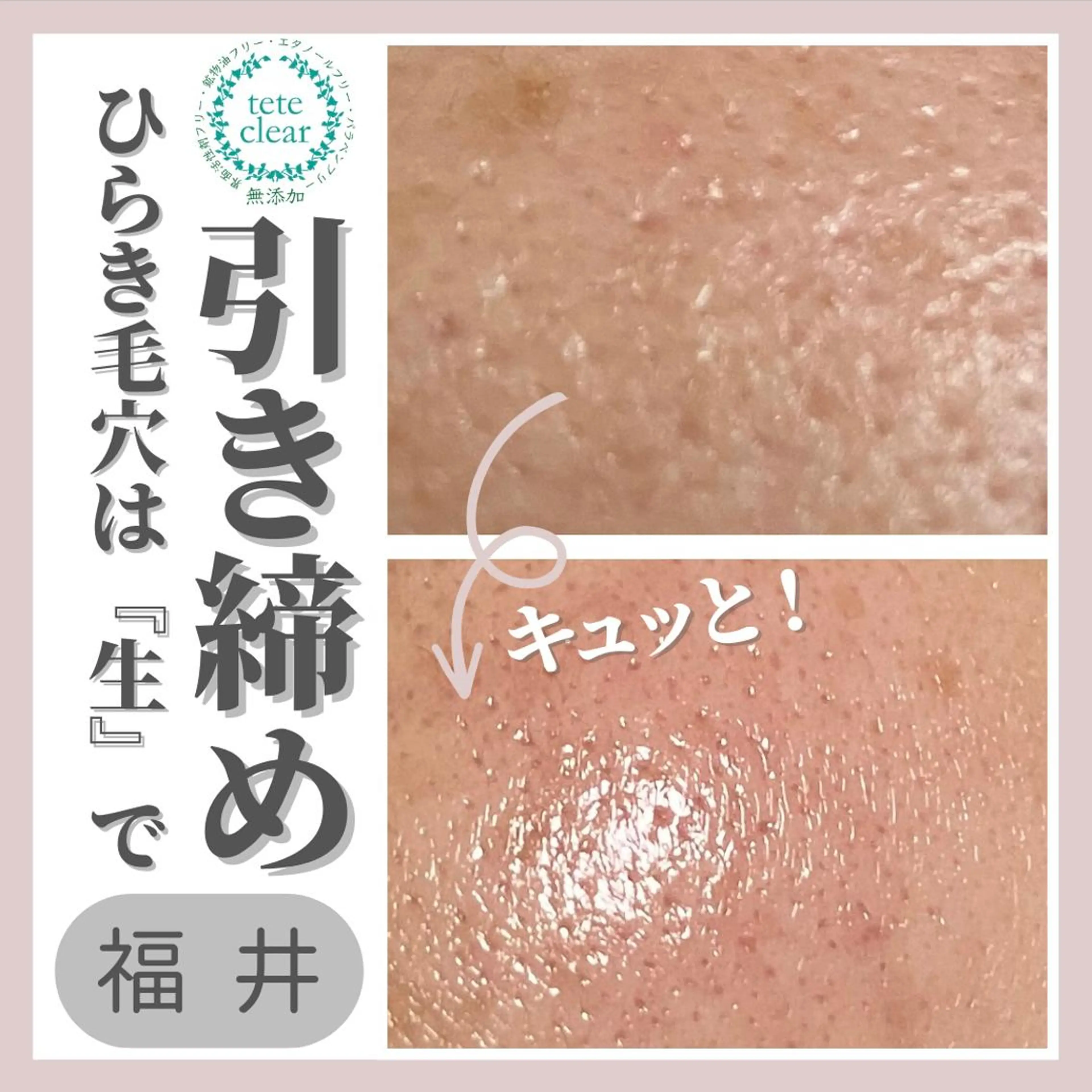 毛穴肌質ケアサロン Yourmeユアミーのエステ・リラクイメージ