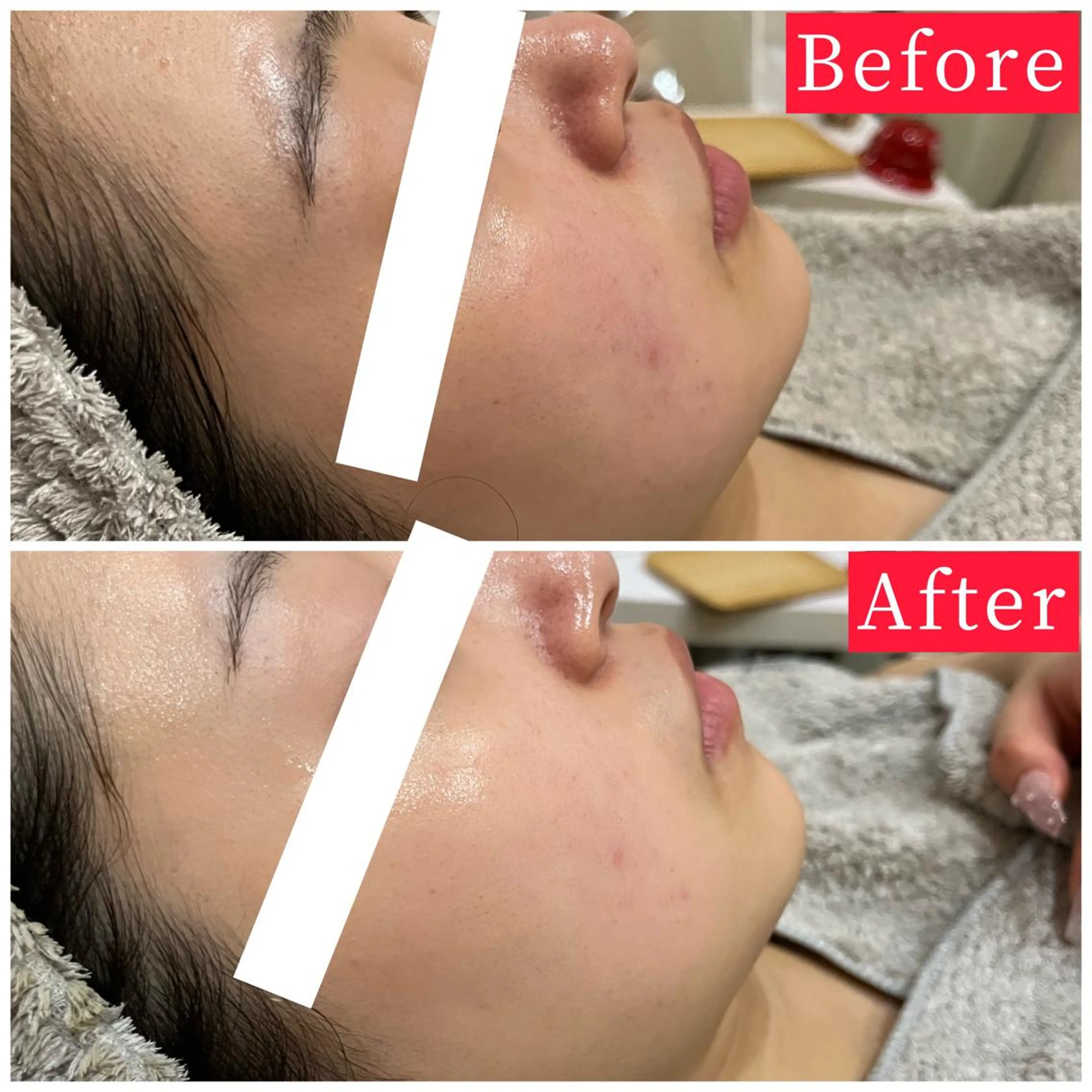 ハーブピーリング専門 muro.のエステ・リラクイメージ