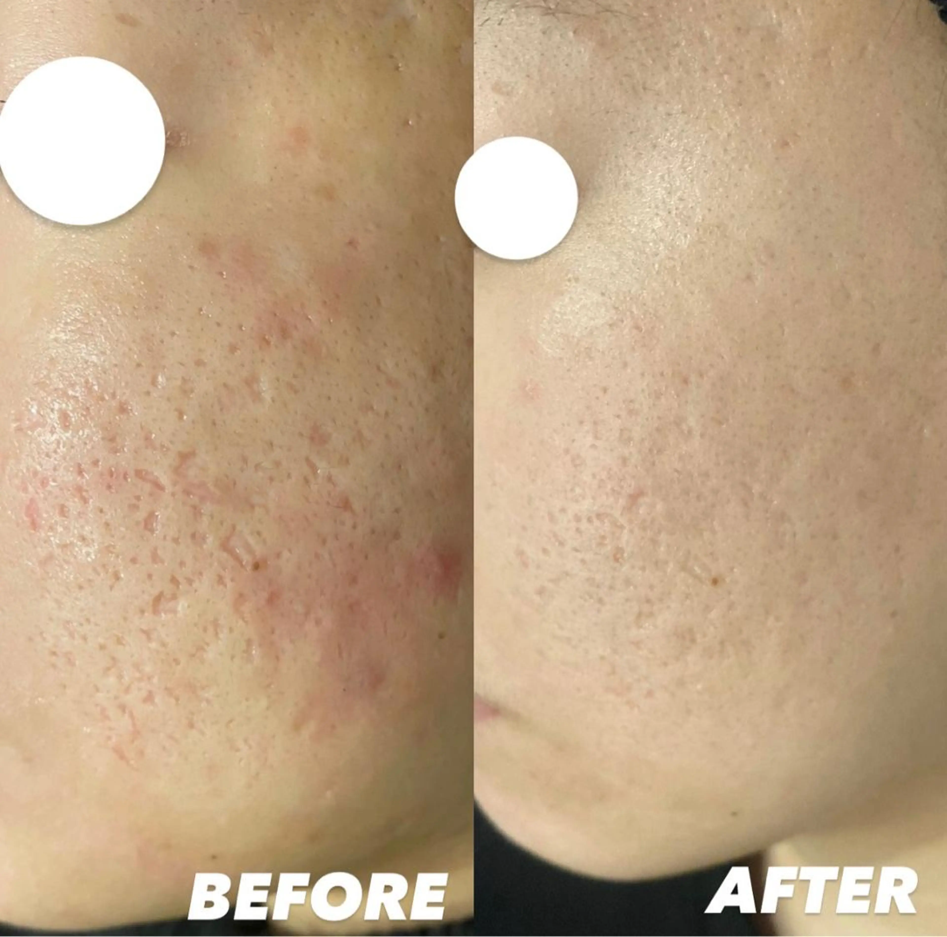 ショート カラー パーマ ヘアアレンジ メンズ キッズ ネイル マツエク・マツパ アイブロウ エステ リラク NANI OAFU所属・NANIOAFU [なんば店］のその他イメージ