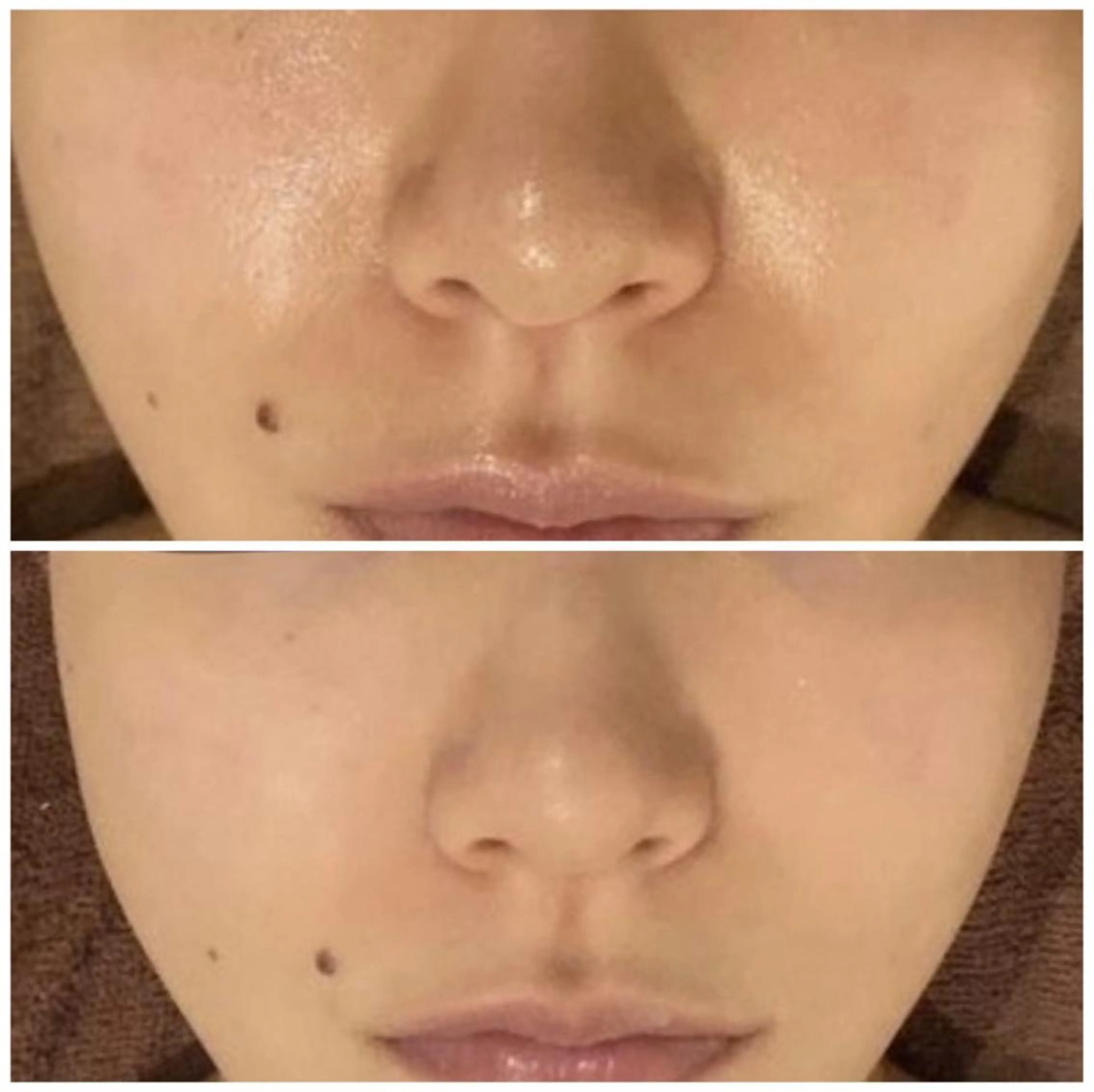 夏までに肌荒れ卒業 するサロン🌻のエステ・リラクイメージ