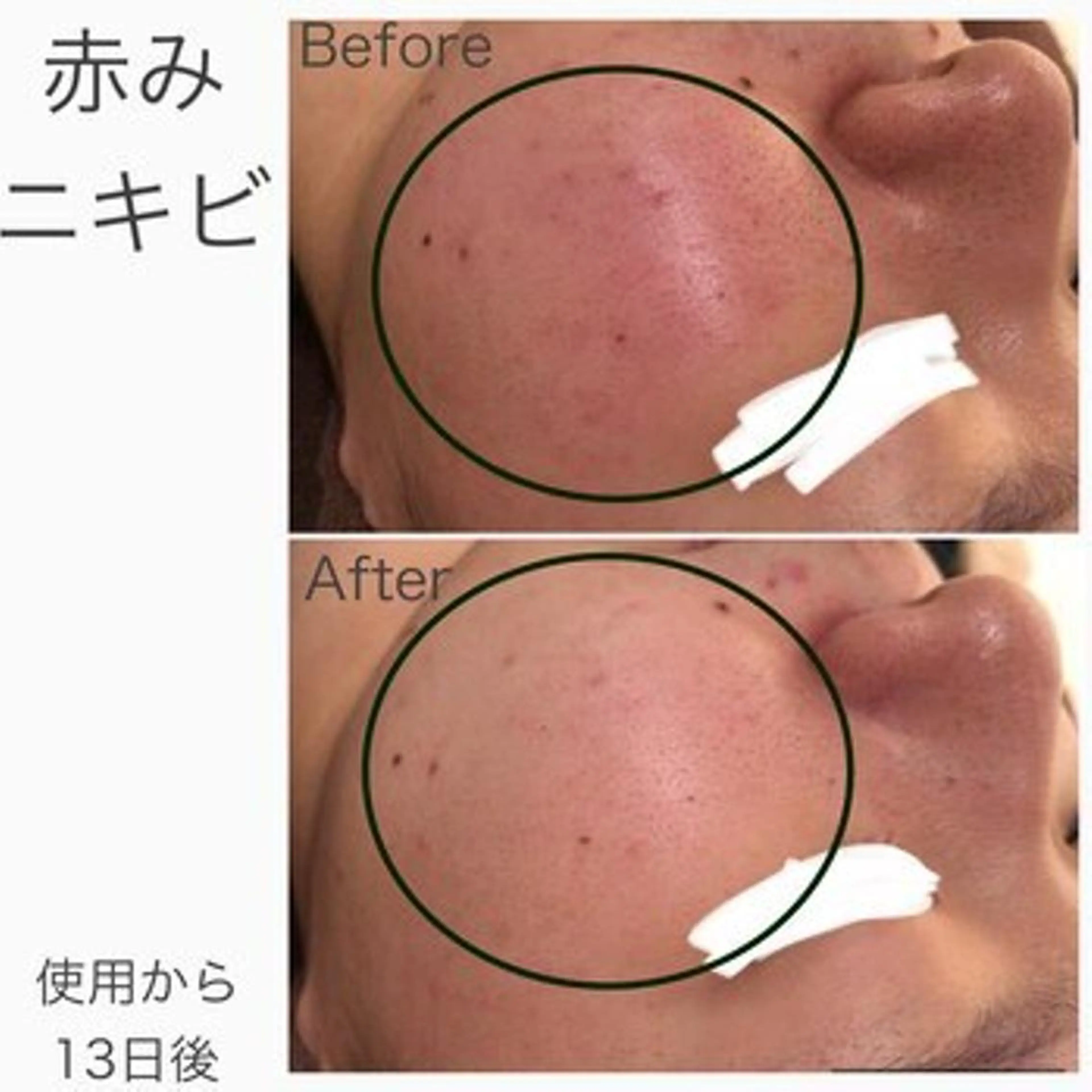 エステ リラク 触れたくなる モテ肌へ...❤︎のエステ・リラクイメージ