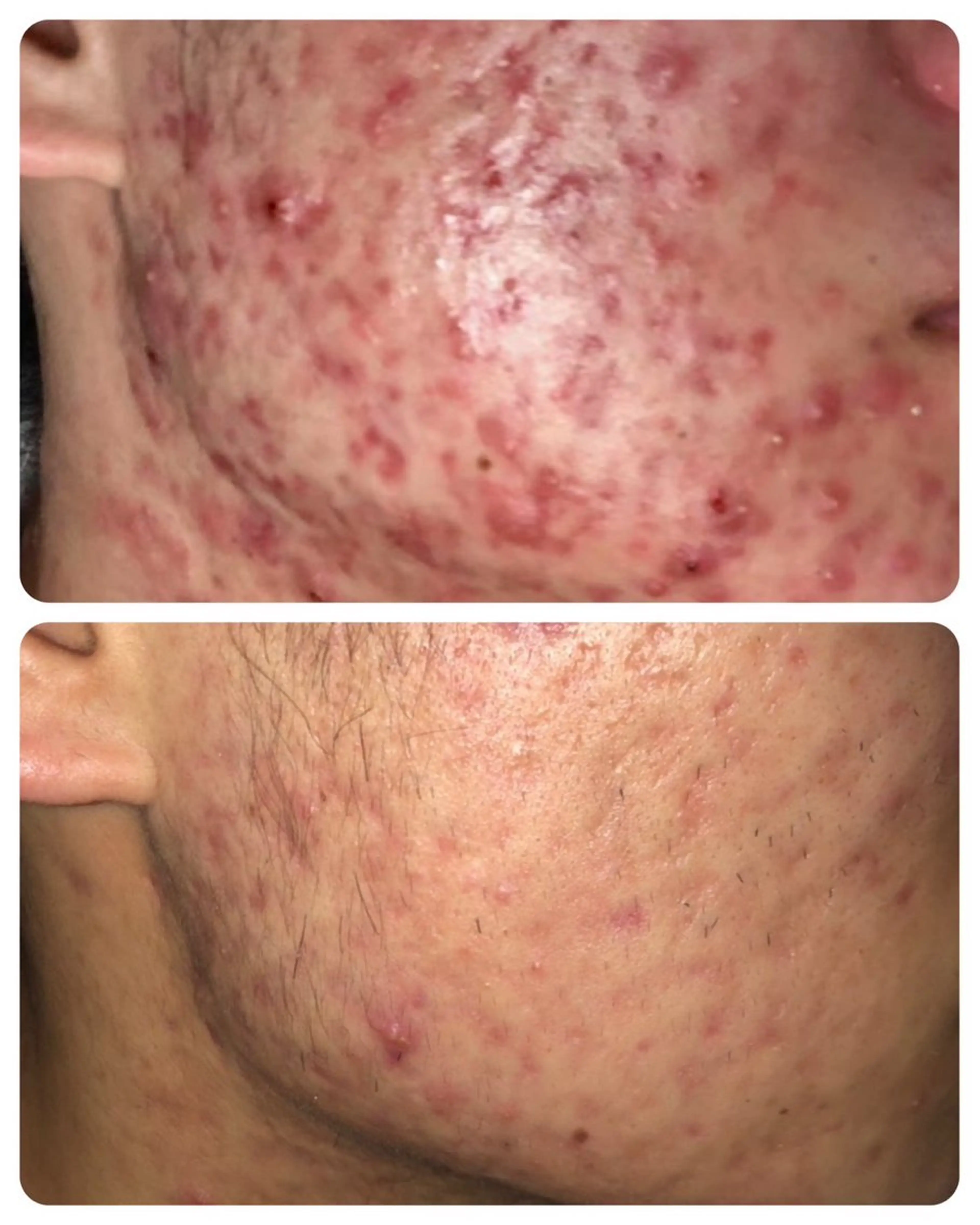 Lussera(ルセラ)所属・肌質を変えて すっぴん肌に✨のその他イメージ