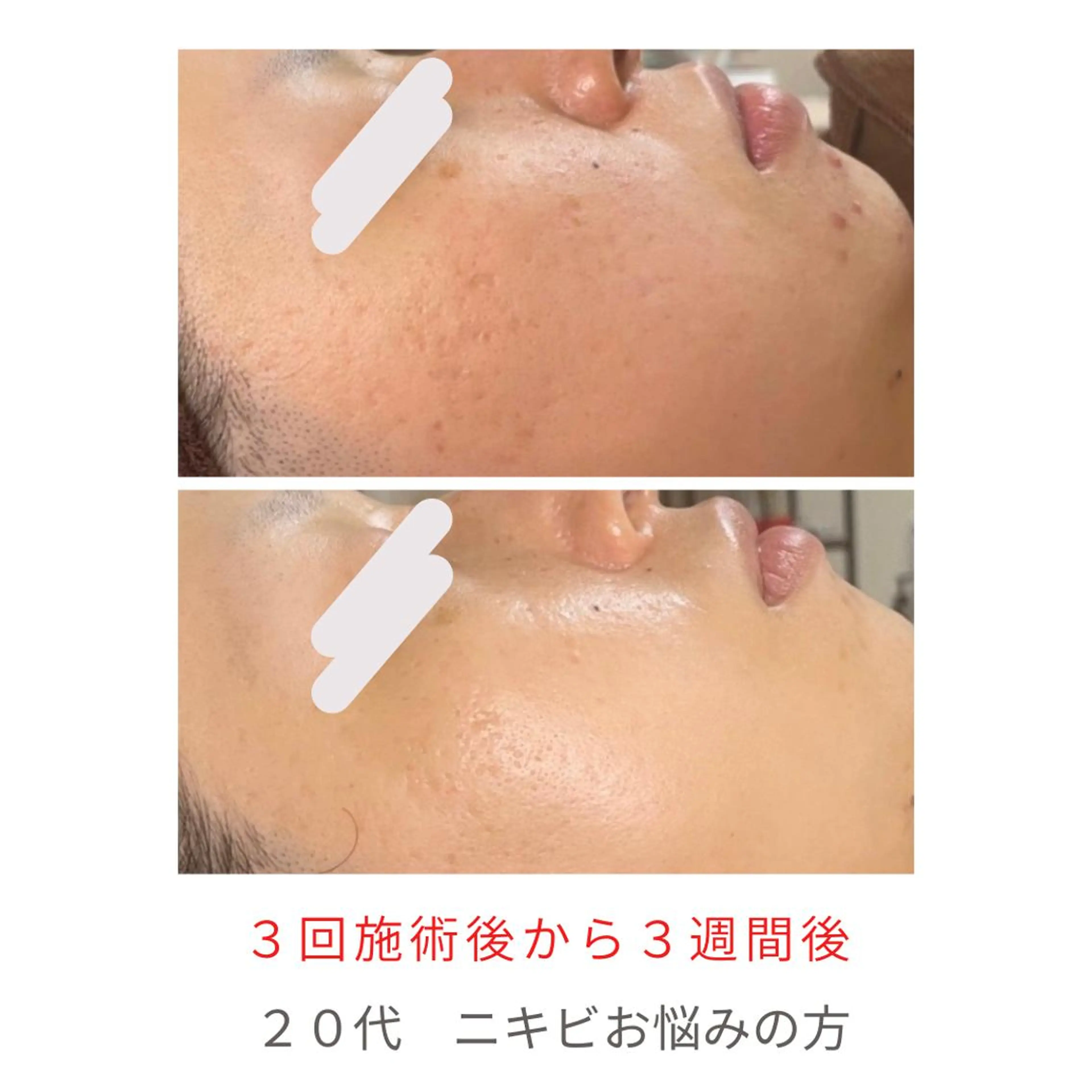 ベラージュ【美背中・ 美尻・フェイシャル】のエステ・リラクイメージ