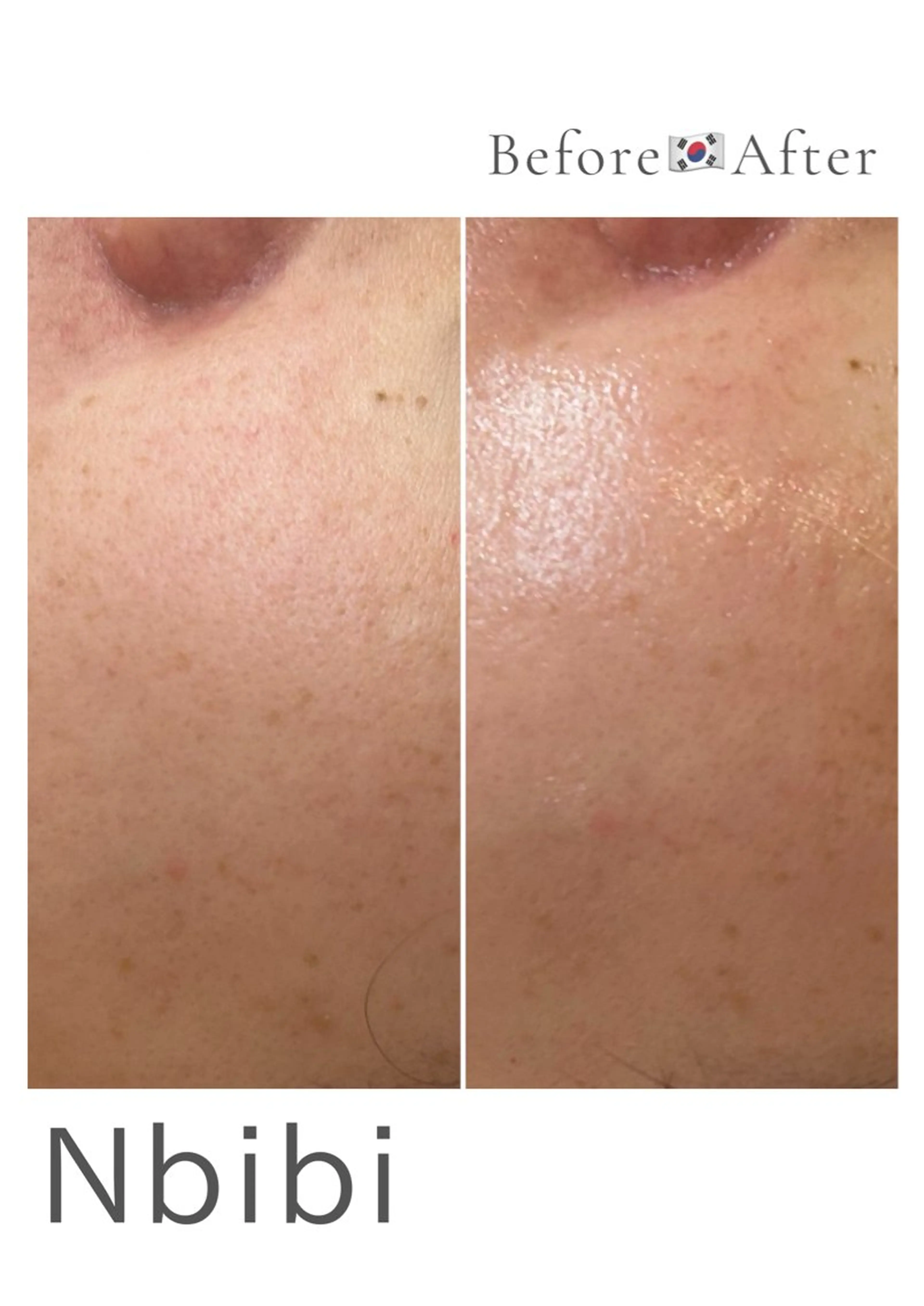 韓国🇰🇷価格 サロン_Nbibiのエステ・リラクイメージ