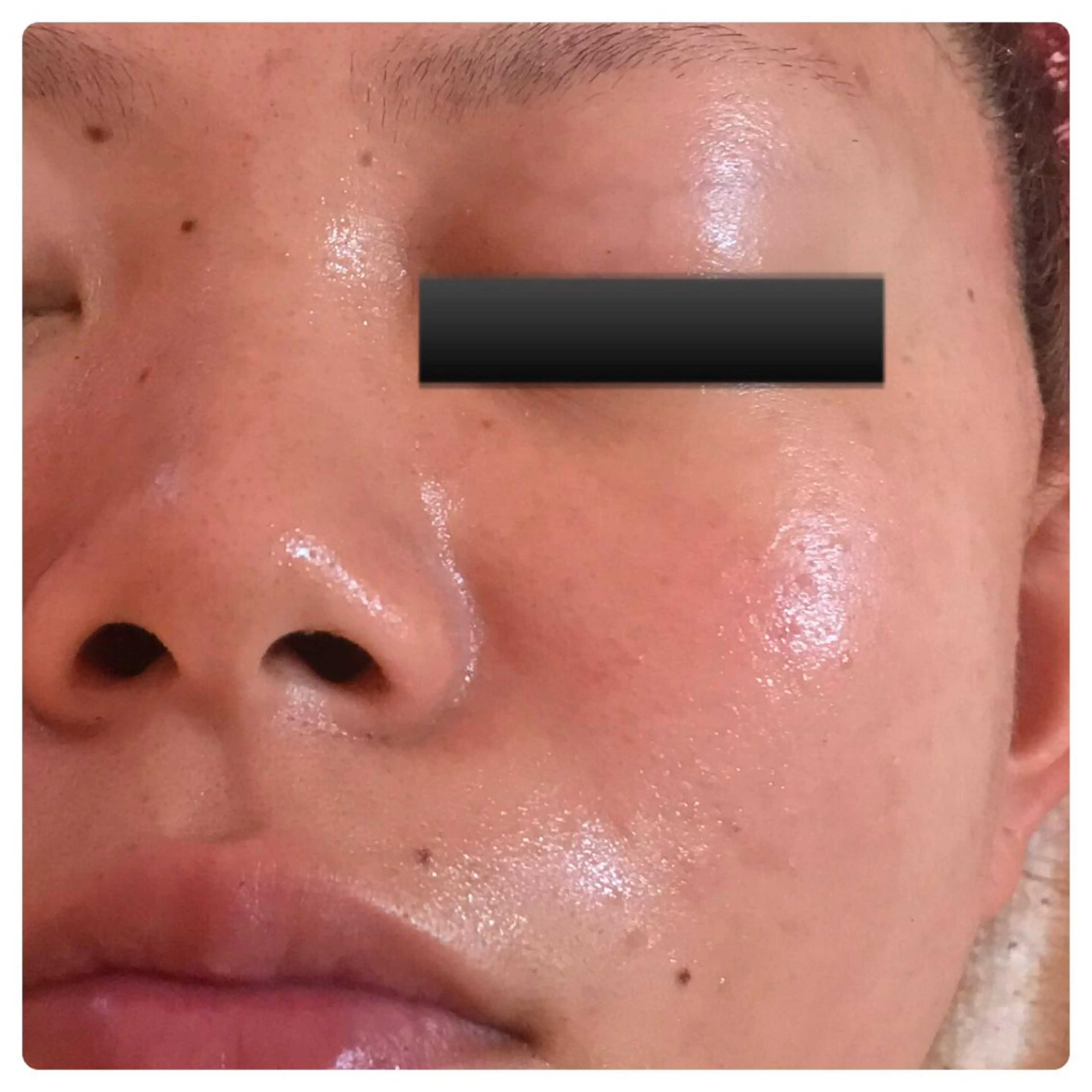 フェアリーローズ所属・fairyrose organicエステのエステ・リラクイメージ