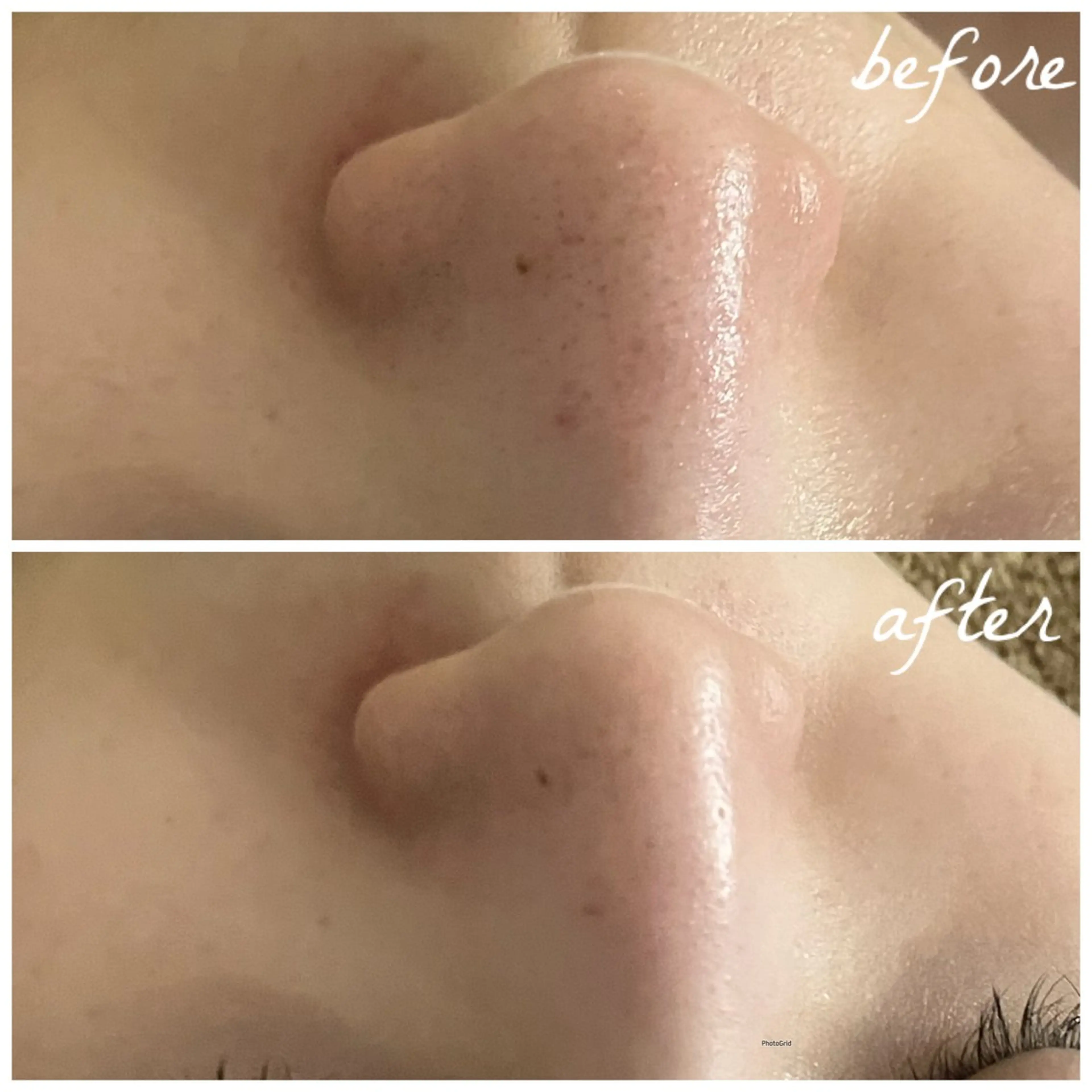 メンズ エステ メナード岐阜茜部 杉浦のエステ・リラクイメージ