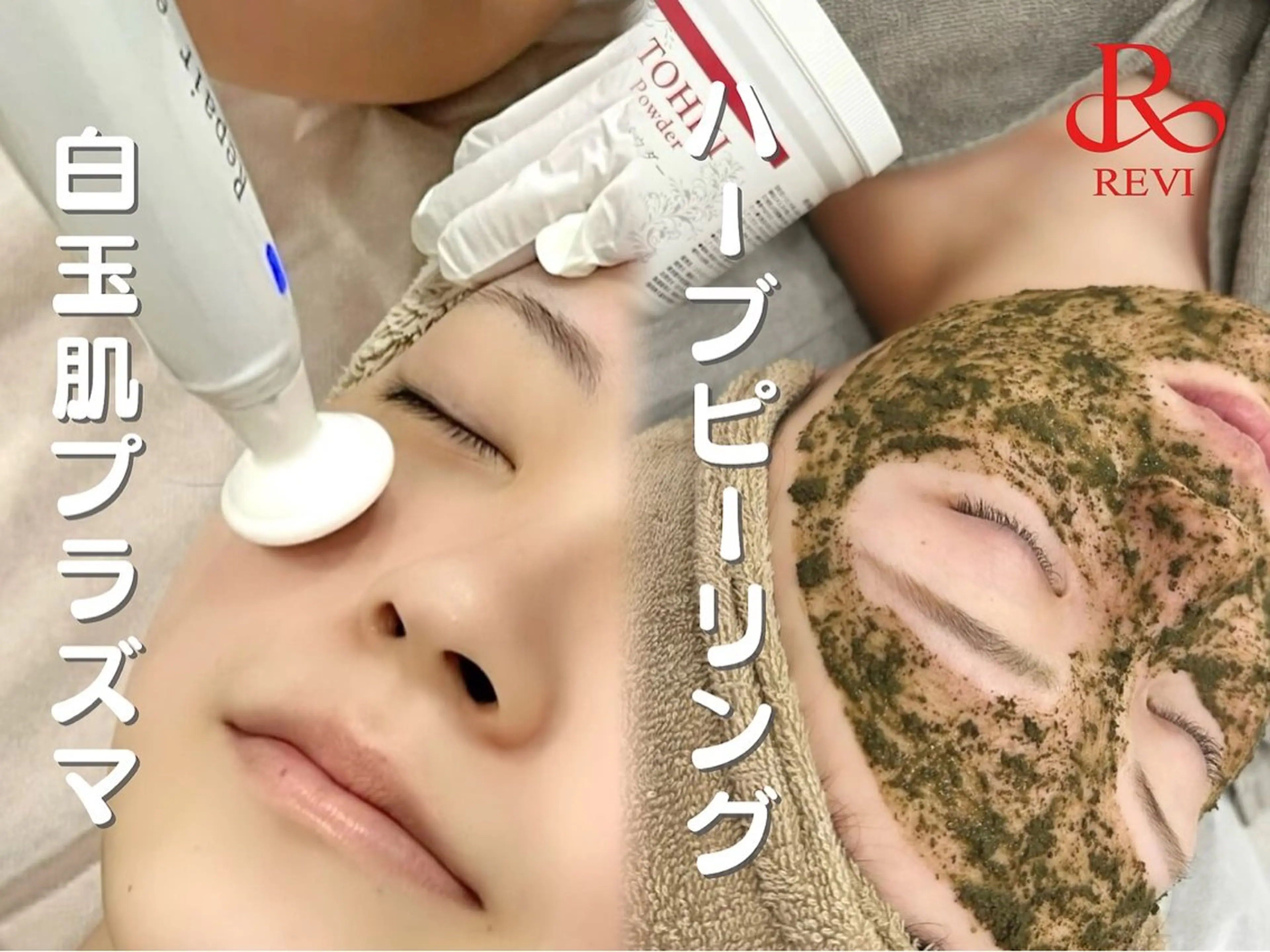 【浸透率格上げ】プラズマ×ハーブピーリングでピーリング効果を最大に！の写真