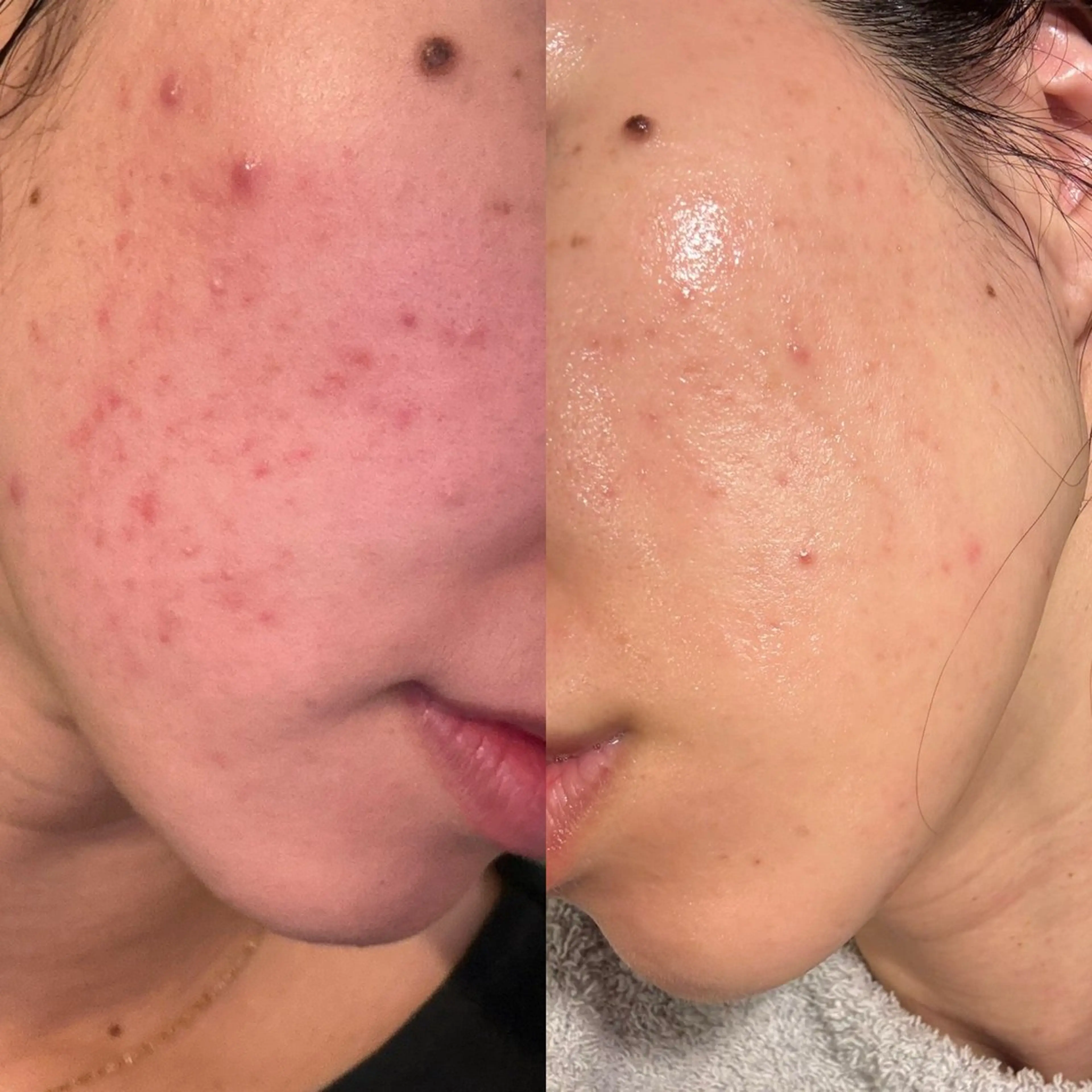 エステ beauty salon mimo所属・かわなべ なつきのエステ・リラクイメージ